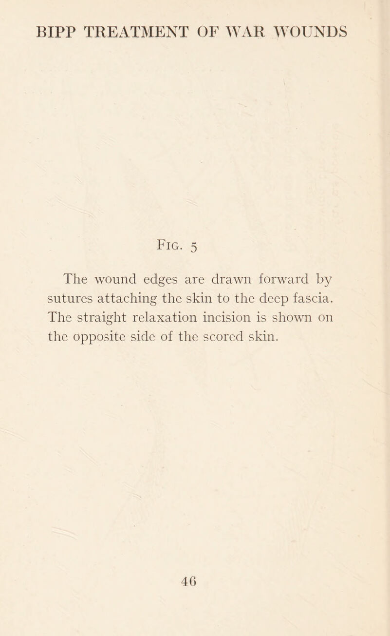 Fig. 5 The wound edges are drawn forward by sutures attaching the skin to the deep fascia. The straight relaxation incision is shown on the opposite side of the scored skin. 40