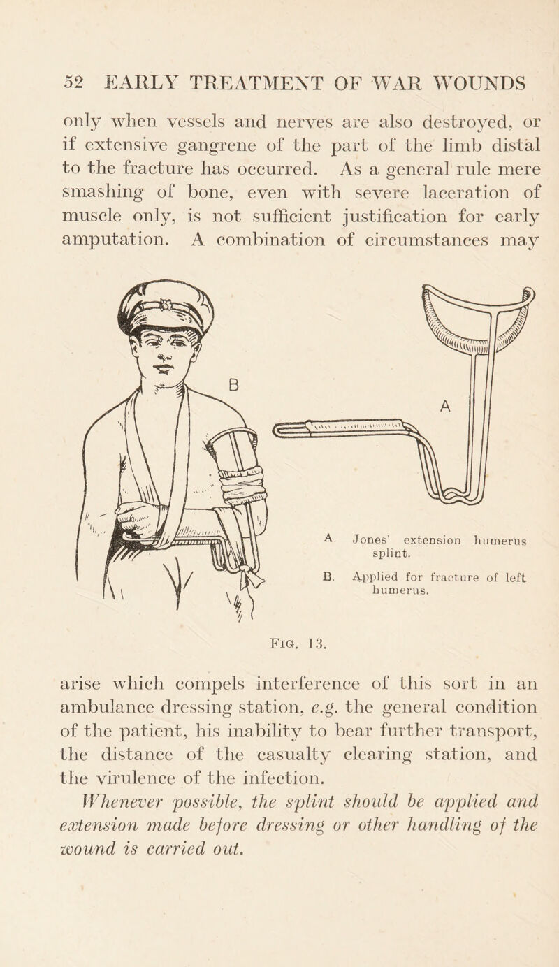 only when vessels and nerves are also destroyed, or if extensive gangrene of the part of the limb distal to the fracture has occurred. As a general rule mere smashing of bone, even with severe laceration of muscle only, is not sufficient justification for early amputation. A combination of circumstances may Fig. 13. arise which compels interference of this sort in an ambulance dressing station, e.g. the general condition of the patient, his inability to bear further transport, the distance of the casualty clearing station, and the virulence of the infection. Whenever possible, the splint should be applied and extension made before dressing or other handling of the wound is carried out.