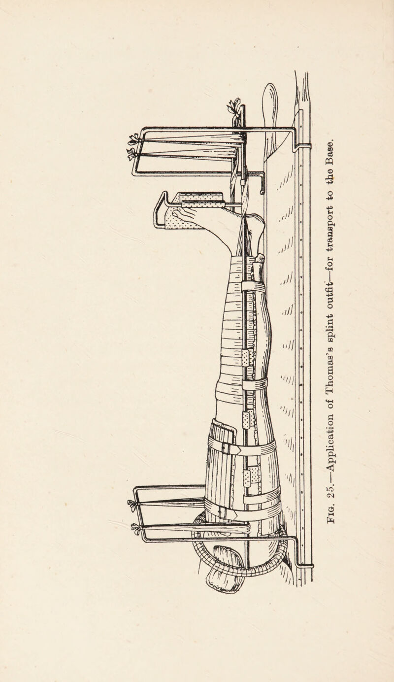 Fig. 25.—Application of Thomas’s splint outfit—for transport to the Base.