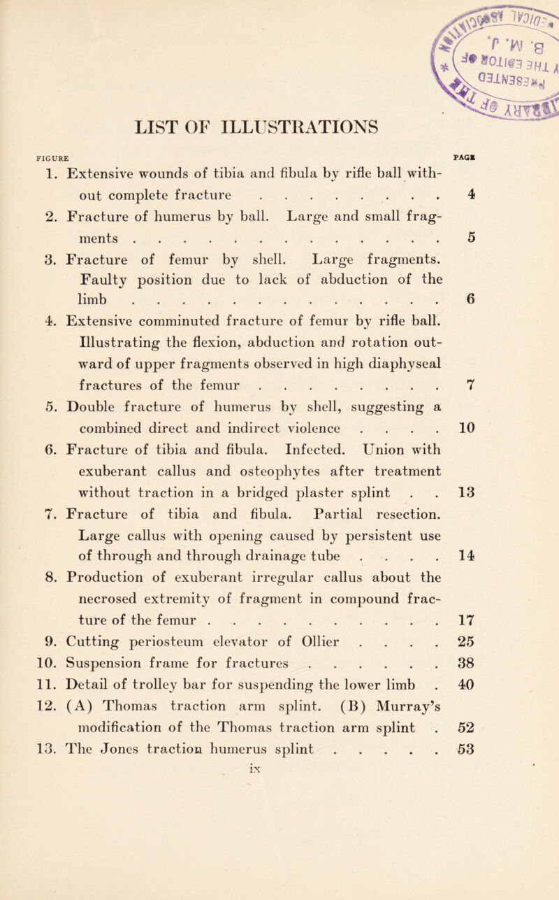 LIST OF ILLUSTRATIONS FIGURE FAG* 1. Extensive wounds of tibia and fibula by rifle ball with¬ out complete fracture.4 2. Fracture of humerus by ball. Large and small frag¬ ments . 5 3. Fracture of femur by shell. Large fragments. Faulty position due to lack of abduction of the limb...6 4. Extensive comminuted fracture of femur by rifle ball. Illustrating the flexion, abduction and rotation out¬ ward of upper fragments observed in high diaphyseal fractures of the femur.7 5. Double fracture of humerus by shell, suggesting a combined direct and indirect violence .... 10 6. Fracture of tibia and fibula. Infected. LTnion with exuberant callus and osteophytes after treatment without traction in a bridged plaster splint . . 13 7. Fracture of tibia and fibula. Partial resection. Large callus with opening caused by persistent use of through and through drainage tube . . . . 14 8. Production of exuberant irregular callus about the necrosed extremity of fragment in compound frac¬ ture of the femur.17 9. Cutting periosteum elevator of Ollier .... 25 10. Suspension frame for fractures.38 11. Detail of trolley bar for suspending the lower limb . 40 12. (A) Thomas traction arm splint. (B) Murray’s modification of the Thomas traction arm splint . 52 13. The Jones traction humerus splint.53 * * V Q 031N383»4