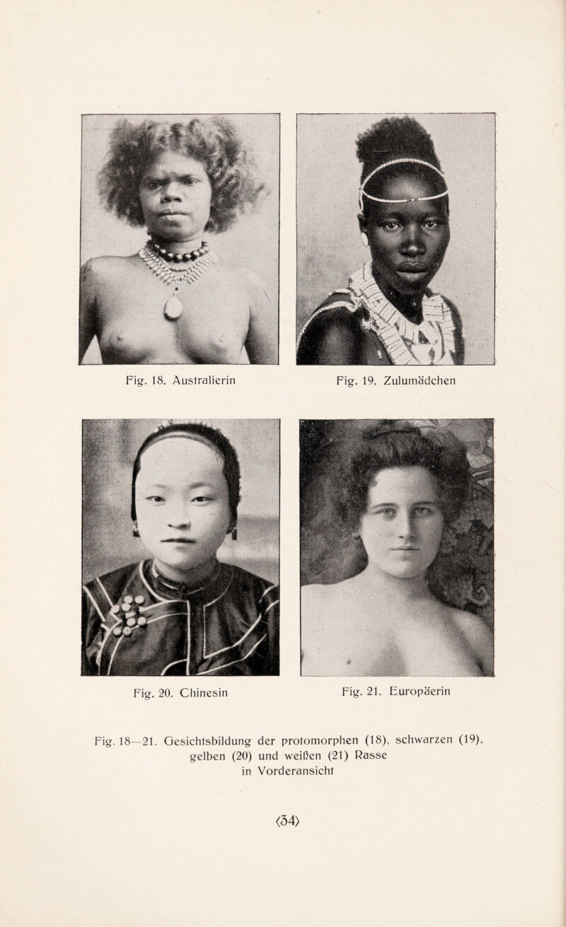 Fig. 20. Chinesin Fig. 21. Europäerin Fig. 18—21. Gesichtsbildung der protomorphen (18), schwarzen (19), gelben (20) und weißen (21) Rasse in Vorderansicht <54>