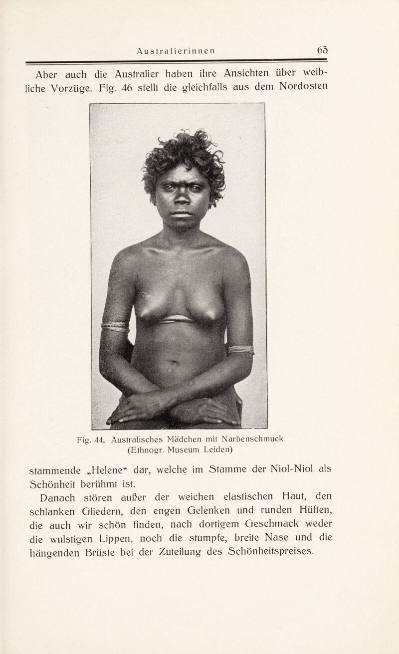 Aber auch die Australier haben ihre Ansichten über weib¬ liche Vorzüge. Fig. 46 stellt die gleichfalls aus dem Nordosten Fig. 44. Australisches Mädchen mit Narbenschmuck (Ethnogr. Museum Leiden) stammende „Helene“ dar, welche im Stamme der Niol-Niol als Schönheit berühmt ist. Danach stören außer der weichen elastischen Haut, den schlanken Gliedern, den engen Gelenken und runden Hüften, die auch wir schön finden, nach dortigem Geschmack weder die wulstigen Lippen, noch die stumpfe, breite Nase und die hängenden Brüste bei der Zuteilung des Schönheitspreises.