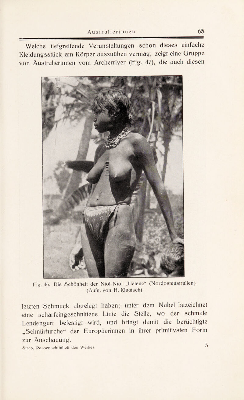 Welche tiefgreifende Verunstaltungen schon dieses einfache Kleidungsstück am Körper auszuüben vermag, zeigt eine Gruppe von Australierinnen vom Archerriver (Fig. 47), die auch diesen Fig. 46. Die Schönheit der Niol-Niol „Flelene“ (Nordostaustralien) (Aufn. von H. Klaatsch) letzten Schmuck abgelegt haben; unter dem Nabel bezeichnet eine scharfeingeschnittene Linie die Stelle, wo der schmale Lendengurt befestigt wird, und bringt damit die berüchtigte „Schnürturche“ der Europäerinnen in ihrer primitivsten Form zur Anschauung. Sfra!?, Rassenschönheit des Weibes