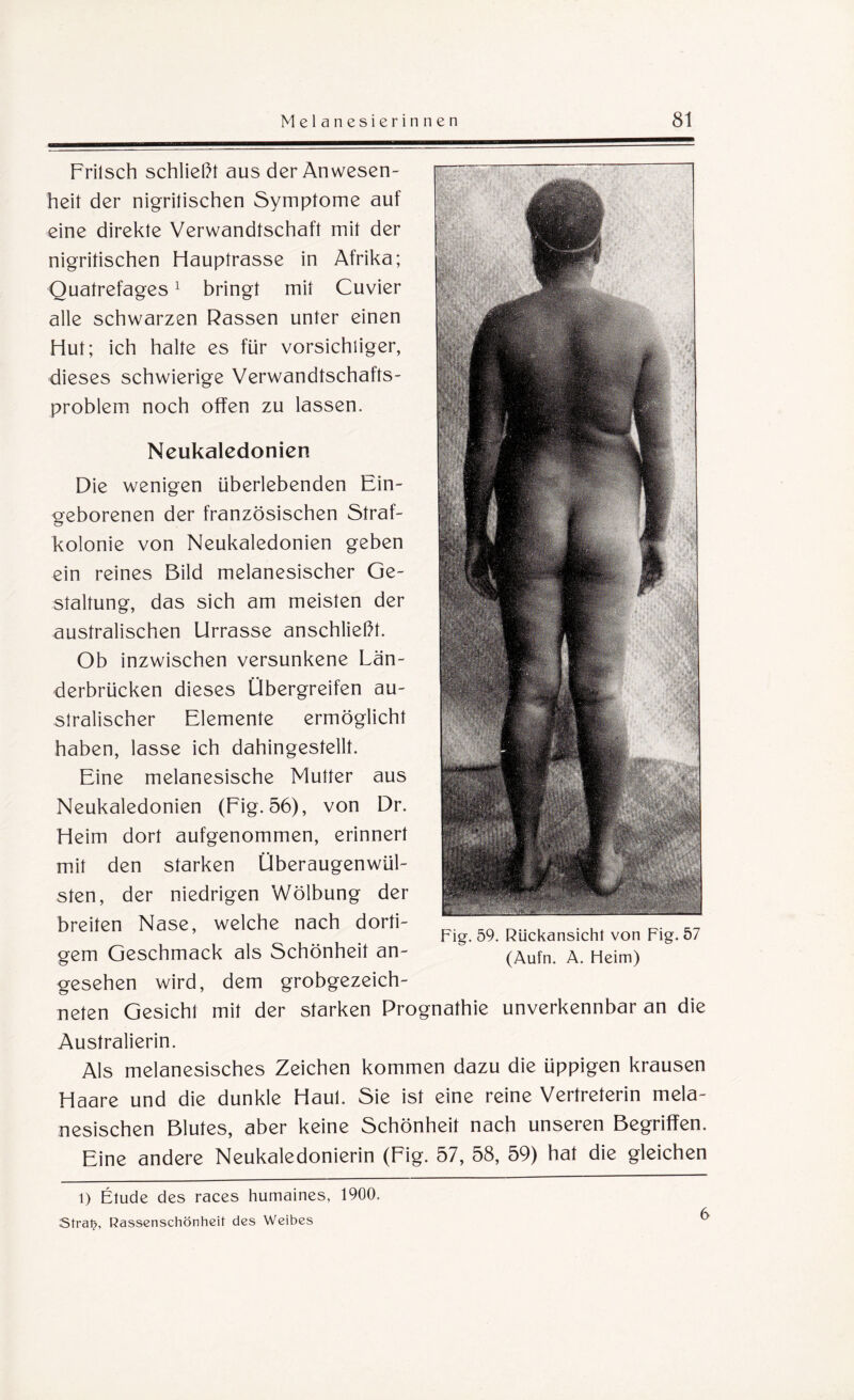 Frilsch schließt aus der Anwesen¬ heit der nigritischen Symptome auf eine direkte Verwandtschaft mit der nigritischen Hauptrasse in Afrika; Ouatrefages1 bringt mit Cuvier alle schwarzen Rassen unter einen Hut; ich halte es für vorsichtiger, dieses schwierige Verwandtschafts¬ problem noch offen zu lassen. Neukaledonien Die wenigen überlebenden Ein¬ geborenen der französischen Straf¬ kolonie von Neukaledonien geben ein reines Bild melanesischer Ge¬ staltung, das sich am meisten der australischen Urrasse anschließt. Ob inzwischen versunkene Län¬ derbrücken dieses Übergreifen au¬ stralischer Elemente ermöglicht haben, lasse ich dahingestellt. Eine melanesische Mutter aus Neukaledonien (Fig. 56), von Dr. Heim dort aufgenommen, erinnert mit den starken Überaugenwül¬ sten, der niedrigen Wölbung der breiten Nase, welche nach dorti¬ gem Geschmack als Schönheit an¬ gesehen wird, dem grobgezeich¬ neten Gesicht mit der starken Prognathie unverkennbar an die Fig. 59. Rückansicht von Fig. 57 (Aufn. A. Heim) Australierin. Als melanesisches Zeichen kommen dazu die üppigen krausen Haare und die dunkle Haul. Sie ist eine reine Vertreterin mela- nesischen Blutes, aber keine Schönheit nach unseren Begriffen. Eine andere Neukaledonierin (Fig. 57, 58, 59) hat die gleichen l) Etüde des races humaines, 1900. Stratj, Rassenschönheit des Weibes