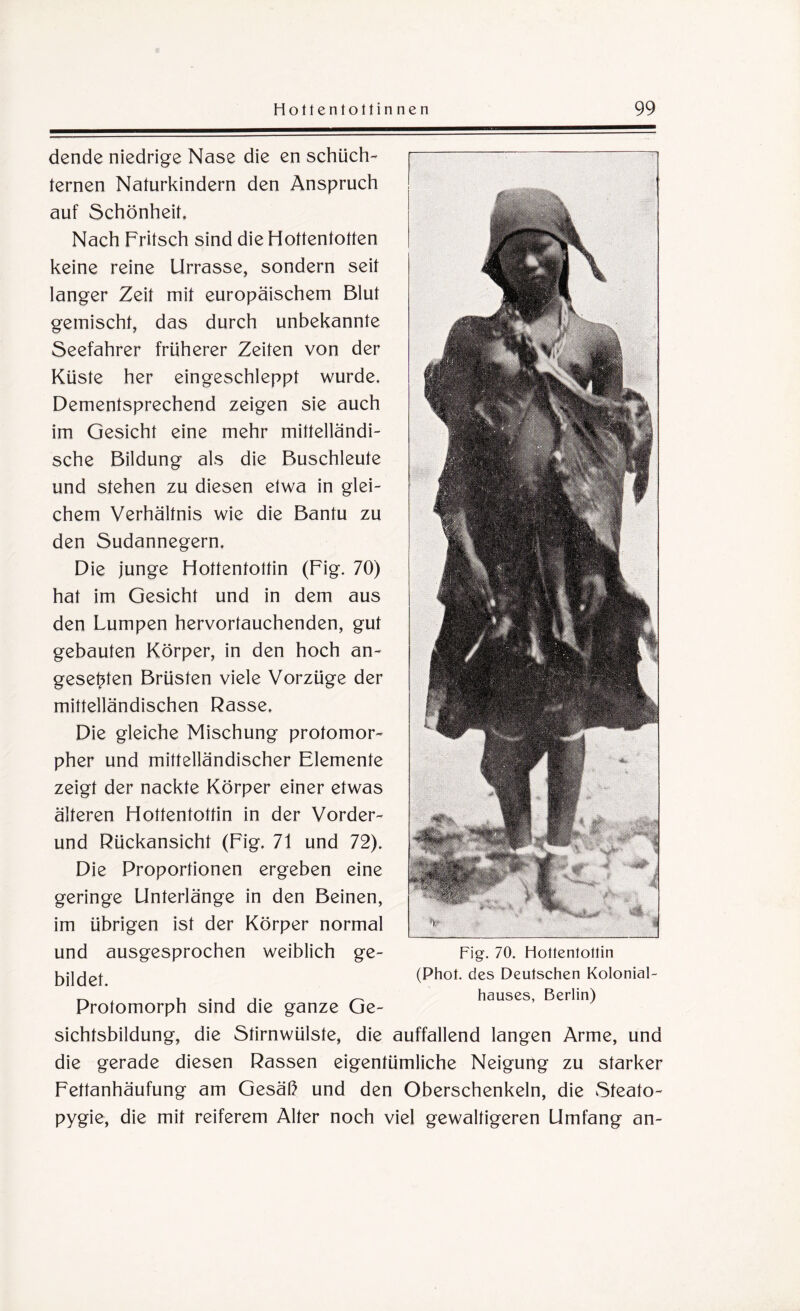 dende niedrige Nase die en schüch¬ ternen Naturkindern den Anspruch auf Schönheit, Nach Fritsch sind die Hottentotten keine reine Urrasse, sondern seit langer Zeit mit europäischem Blut gemischt, das durch unbekannte Seefahrer früherer Zeiten von der Küste her eingeschleppt wurde. Dementsprechend zeigen sie auch im Gesicht eine mehr mittelländi¬ sche Bildung als die Buschleute und stehen zu diesen etwa in glei¬ chem Verhältnis wie die Bantu zu den Sudannegern. Die junge Hottentottin (Fig. 70) hat im Gesicht und in dem aus den Lumpen hervortauchenden, gut gebauten Körper, in den hoch an¬ gesehen Brüsten viele Vorzüge der mittelländischen Rasse. Die gleiche Mischung protomor- pher und mittelländischer Elemente zeigt der nackte Körper einer etwas älteren Hottentottin in der Vorder- und Rückansicht (Fig. 71 und 72). Die Proportionen ergeben eine geringe Unterlänge in den Beinen, im übrigen ist der Körper normal und ausgesprochen weiblich ge¬ bildet. Protomorph sind die ganze Ge- Fig. 70. Hottentottin (Phot, des Deutschen Kolonial¬ hauses, Berlin) Sichtsbildung, die Stirnwülste, die auffallend langen Arme, und die gerade diesen Rassen eigentümliche Neigung zu starker Fettanhäufung am Gesäß und den Oberschenkeln, die Steato- pygie, die mit reiferem Alter noch viel gewaltigeren Umfang an-