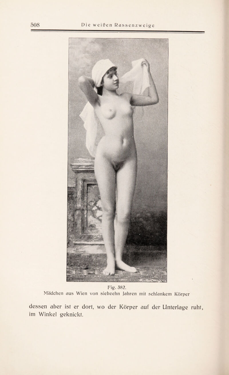 Fig. 382. Mädchen aus Wien von siebzehn Jahren mit schlankem Körper dessen aber ist er dort, wo der Körper auf der Unterlage ruht, im Winkel geknickt.