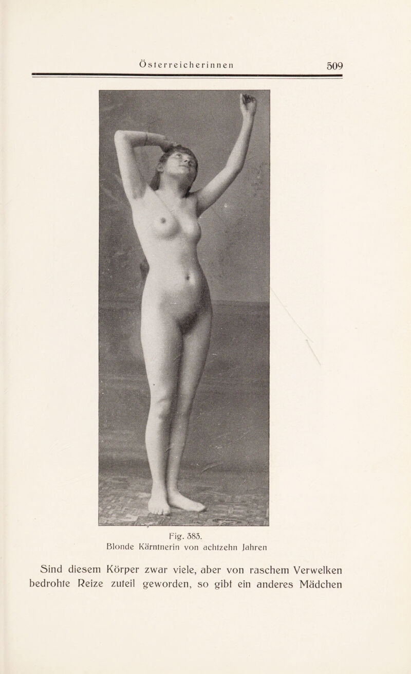 Fig. 585. Blonde Kärntnerin von achtzehn Jahren Sind diesem Körper zwar viele, aber von raschem Verwelken bedrohte Reize zuteil geworden, so gibt ein anderes Mädchen