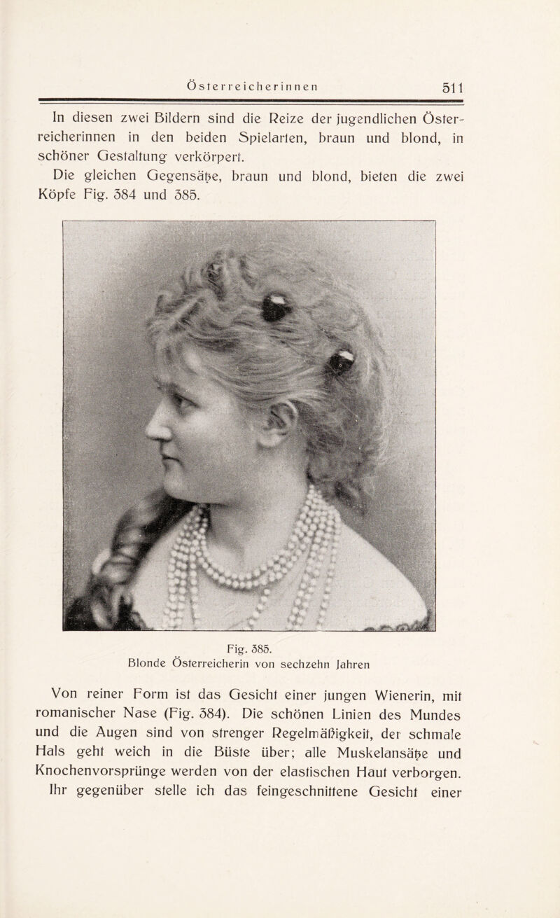 In diesen zwei Bildern sind die Reize der jugendlichen Öster¬ reicherinnen in den beiden Spielarlen, braun und blond, in schöner Gestaltung verkörpert. Die gleichen Gegensätze, braun und blond, bieten die zwei Köpfe Fig. 384 und 385. Fig. 385. Blonde Österreicherin von sechzehn Jahren Von reiner Form ist das Gesicht einer jungen Wienerin, mit romanischer Nase (Fig. 384). Die schönen Linien des Mundes und die Augen sind von strenger Regelmäßigkeit, der schmale Hals geht weich in die Büste über; alle Muskelansä^e und Knochenvorsprünge werden von der elastischen Haut verborgen. Ihr gegenüber stelle ich das feingeschnittene Gesicht einer