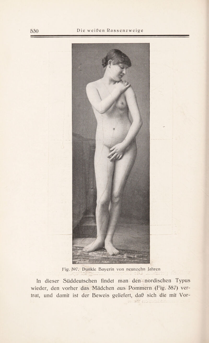 Fig. 397. Dunkle Bayerin von neunzehn Jahren In dieser Süddeutschen findet man den nordischen Typus wieder, den vorher das Mädchen aus Pommern (Fig. 387) ver¬ trat, und damit ist der Beweis geliefert, daß sich die mit Vor-