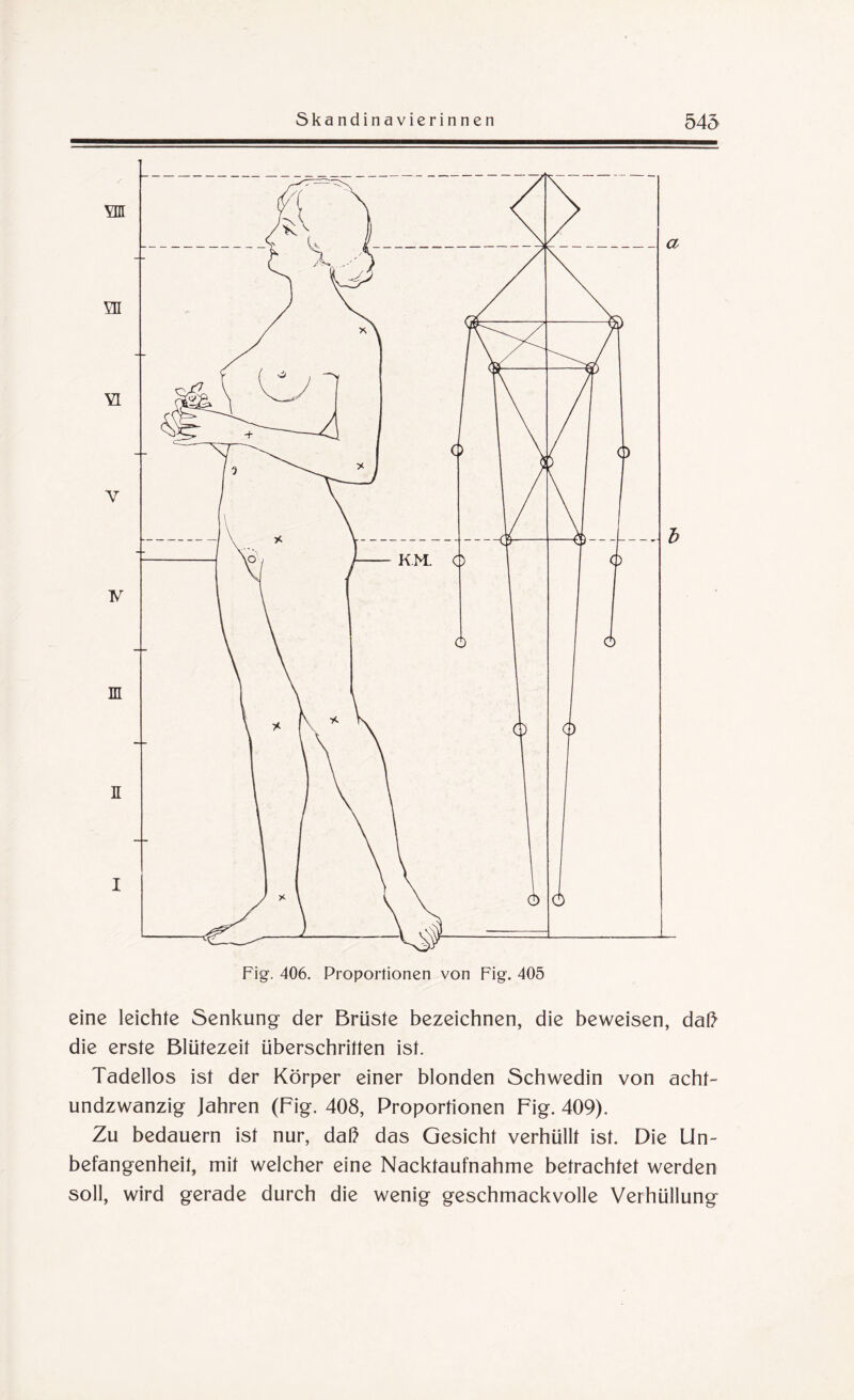 eine leichte Senkung der Brüste bezeichnen, die beweisen, daß die erste Blütezeit überschritten ist. Tadellos ist der Körper einer blonden Schwedin von acht¬ undzwanzig Jahren (Fig. 408, Proportionen Fig. 409). Zu bedauern ist nur, daß das Gesicht verhüllt ist. Die Un¬ befangenheit, mit welcher eine Nacktaufnahme betrachtet werden soll, wird gerade durch die wenig geschmackvolle Verhüllung