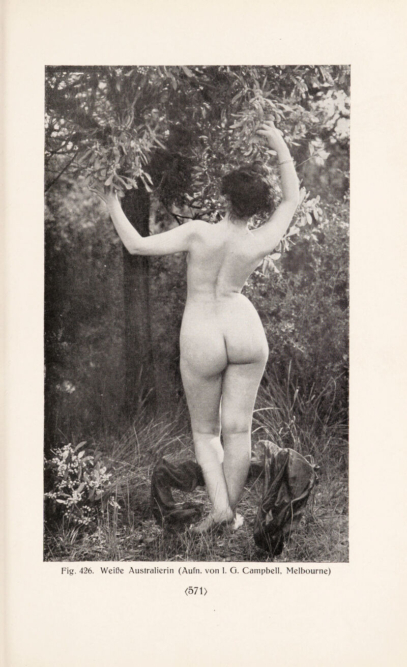 Fig. 426. Weiße Australierin (Aufn. von I. G. Campbell, Melbourne) <571)