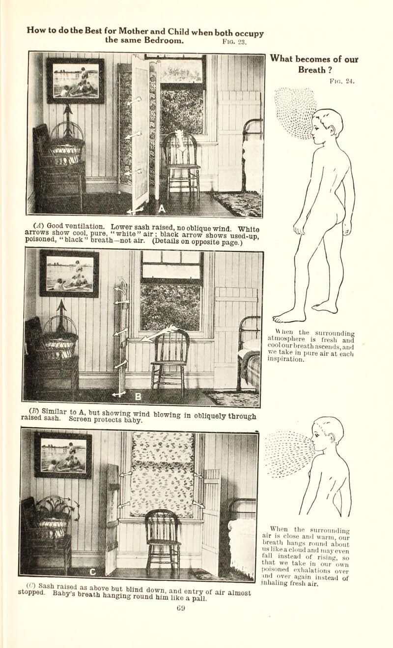 the same Bedroom. Fio. 23. What becomes of our Breath ? Fio. 24. lieu the surroundiiu atmosphere is fresh anc cool our breath ascends, ami we take in pure air at each inspiration. (.4) Good ventilation. Lower sash raised, no oblinue wind White arrows show cool, pure, “ white ” air; black arrow shows used-un poisoned, “ black ” breath—not air. (Details on opposite paste ) P’ raised saSr Screen protecTs'baby.11^ W°Wing ln ^Hquely through air ai When the surrounding air is close and warm, our breath hangs round about us like a cloud and may even fall instead of rising, so that we take in our own poisoned exhalations over ■'l over again instead of inhaling fresh air. G(J