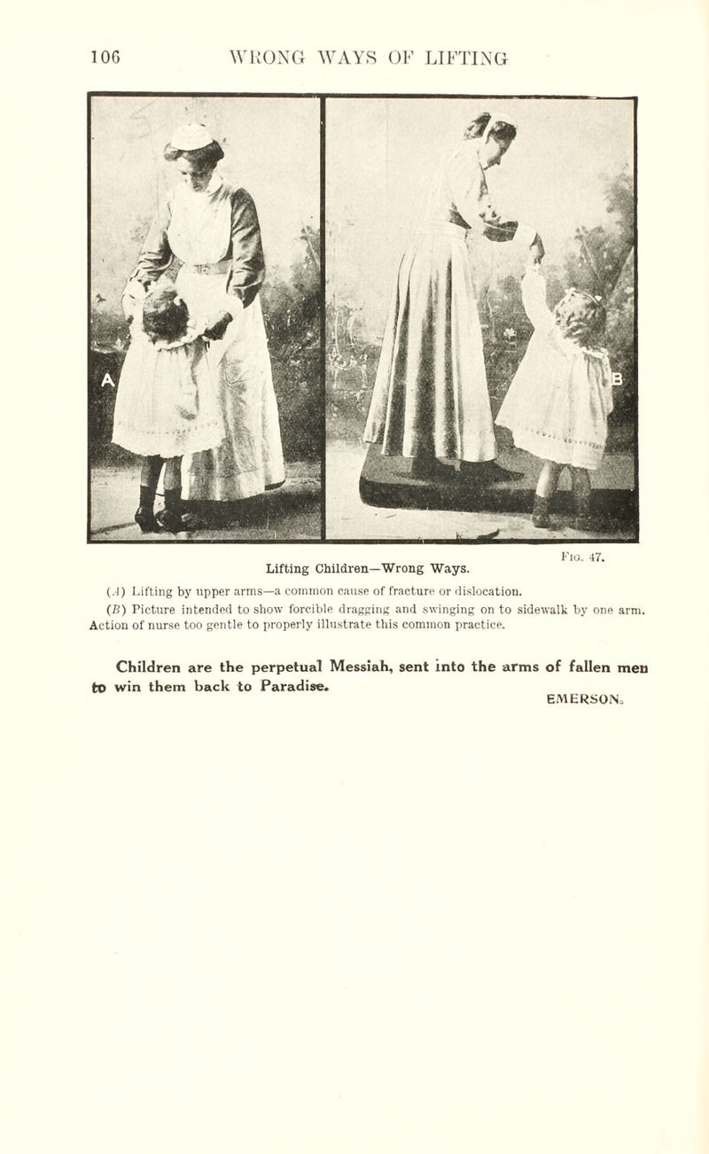 Lifting Children—Wrong Ways. Fio. 47. (.4) Lifting by upper arms—a common cause of fracture or dislocation. (B) Picture intended to show forcible dragging and swinging on to sidewalk by one arm. Action of nurse too gentle to properly illustrate this common practice. Children are the perpetual Messiah, sent into the arms of fallen men to win them back to Paradise. EMERSON,