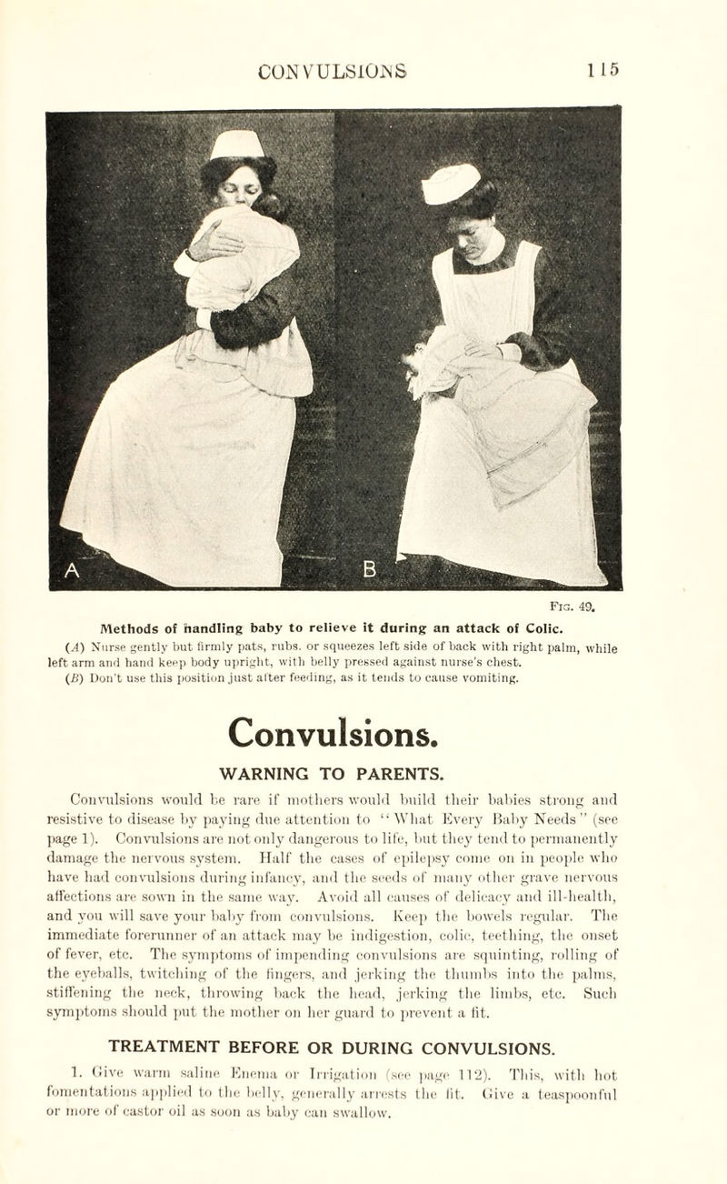 Fig. 49. Methods of handling baby to relieve it during an attack of Colic. (.1) Nurse gently but firmly pats, rubs, or squeezes left side of back with right palm, while left arm and hand keep body upright, with belly pressed against nurse’s chest. (B) Don’t use this position just alter feeding, as it tends to cause vomiting. Convulsions. WARNING TO PARENTS. Convulsions would be rare if mothers would build their babies strong and resistive to disease by paying due attention to “ What Every Baby Needs ” (see page 1). Convulsions are not only dangerous to life, but they tend to permanently damage the nervous system. Half the cases of epilepsy come on in people who have had convulsions during infancy, and the seeds of many other grave nervous affections are sown in the same way. Avoid all causes of delicacy and ill-health, and you will save your bahy from convulsions. Keep the bowels regular. The immediate forerunner of an attack may he indigestion, colic, teething, the onset of fever, etc. The symptoms of impending convulsions are squinting, rolling of the eyeballs, twitching of the fingers, and jerking the thumbs into the palms, stiffening the neck, throwing back the head, jerking the limbs, etc. Such symptoms should put the mother on her guard to prevent a fit. TREATMENT BEFORE OR DURING CONVULSIONS. 1. Give warm saline Enema or Irrigation (see page 112). This, with hot fomentations applied to the belly, generally arrests the fit. Give a teaspoonful or more of castor oil as soon as baby can swallow.
