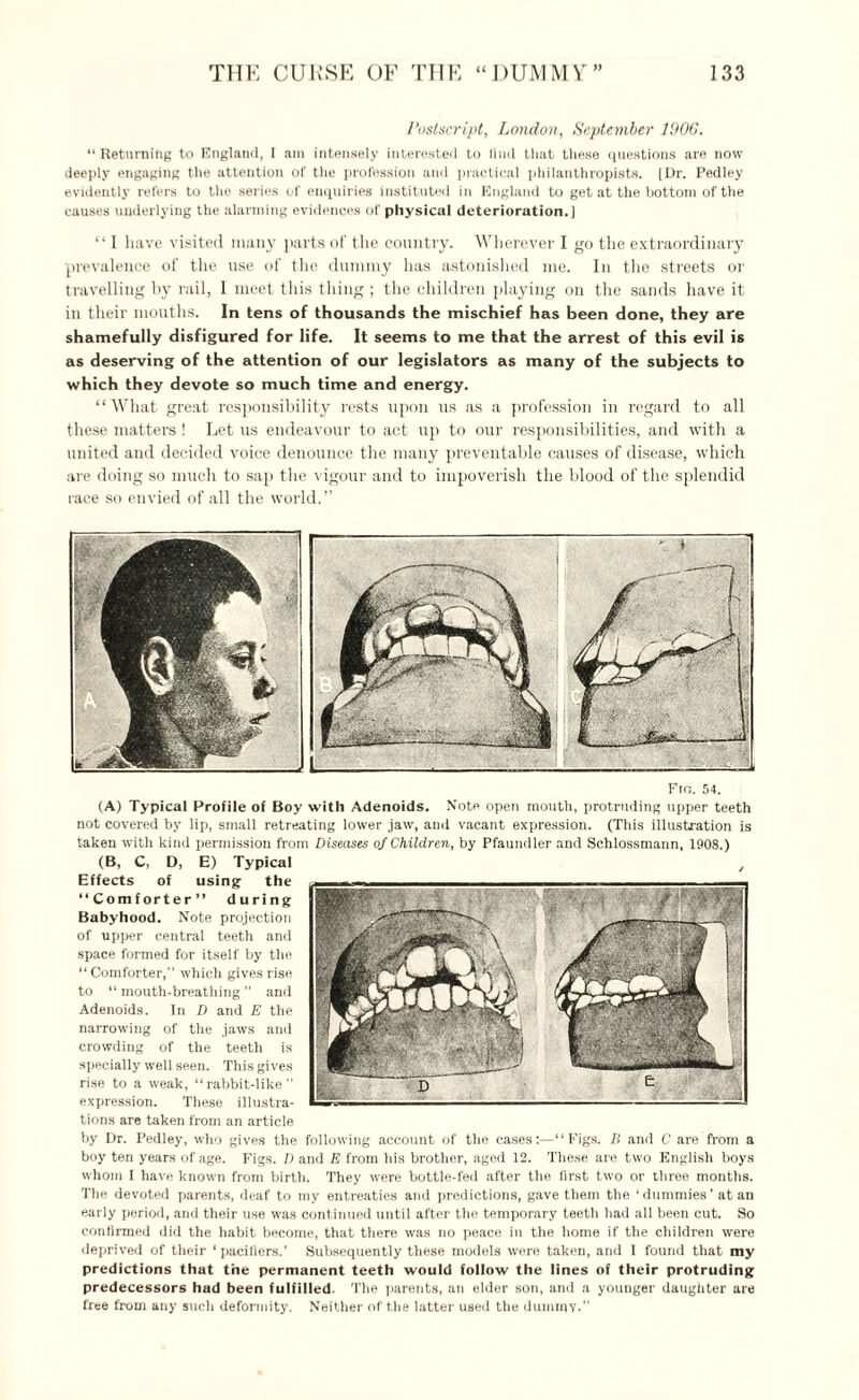 Postscript, London, September 1906. “ Returning to England, I am intensely interested to find that these questions are now deeply engaging the attention of the profession and practical philanthropists. [Dr. Pedley evidently refers to the series of enquiries instituted in England to get at the bottom of the causes underlying the alarming evidences of physical deterioration.] “ I have visited many parts of the country. Wherever I go the extraordinary prevalence of the use of the dummy has astonished me. In the streets or travelling by rail, I meet this thing ; the children playing on the sands have it in their mouths. In tens of thousands the mischief has been done, they are shamefully disfigured for life. It seems to me that the arrest of this evil is as deserving of the attention of our legislators as many of the subjects to which they devote so much time and energy. “What great responsibility rests upon us as a profession in regard to all these matters ! Let us endeavour to act up to our responsibilities, and with a united and decided voice denounce the many preventable causes of disease, which are doing so much to sap the vigour and to impoverish the blood of the splendid race so envied of all the world.” Fro. 54. (A) Typical Profile of Boy with Adenoids. Note open mouth, protruding upper teeth not covered by lip, small retreating lower jaw, and vacant expression. (This illustration is taken with kind permission from Diseases of Children, by Pfaundler and Schlossmann, 1908.) (B, C, D, E) Typical Effects of using the “Comforter” during Babyhood. Note projection of upper central teeth and space formed for itself by the '‘Comforter,” which gives rise to “ mouth-breathing ” and Adenoids. In D and E the narrowing of the jaws and crowding of the teeth is specially well seen. This gives rise to a weak, “rabbit-like ✓ expression. These illustra- ---* tions are taken from an article by Dr. Pedley, who gives the following account of the cases:—“Figs. B and C are from a boy ten years of age. Figs. D and E from his brother, aged 12. These are two English boys whom I have known from birth. They were bottle-fed after the first two or three months. The devoted parents, deaf to my entreaties and predictions, gave them the ‘dummies’ at an early period, and their use was continued until after the temporary teeth had all been cut. So confirmed did the habit become, that there was no peace in the home if the children were deprived of their ‘pacifiers.’ Subsequently these models were taken, and 1 found that my predictions that the permanent teeth would follow the lines of their protruding predecessors had been fulfilled. The parents, an elder son, and a younger daughter are free from any such deformity. Neither of the latter used the dummy.