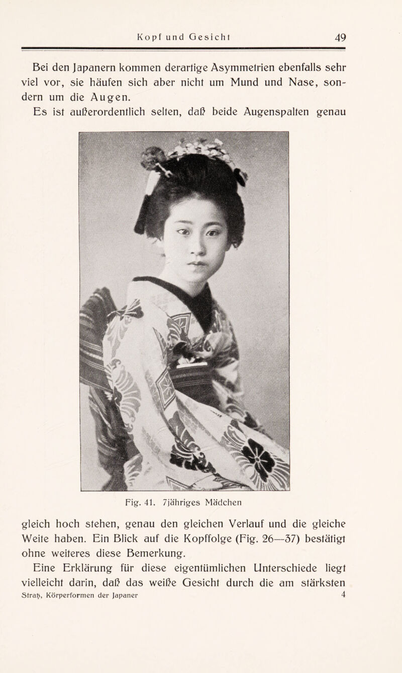 Bei den Japanern kommen derartige Asymmetrien ebenfalls sehr viel vor, sie häufen sich aber nicht um Mund und Nase, son¬ dern um die Augen, Es ist außerordentlich selten, daß beide Augenspalten genau Fig. 41. 7jähriges Mädchen gleich hoch stehen, genau den gleichen Verlauf und die gleiche Weite haben. Ein Blick auf die Kopffolge (Fig. 26—37) bestätigt ohne weiteres diese Bemerkung. Eine Erklärung für diese eigentümlichen Unterschiede liegt vielleicht darin, daß das weiße Gesicht durch die am stärksten Stral?, Körperformen der Japaner 4