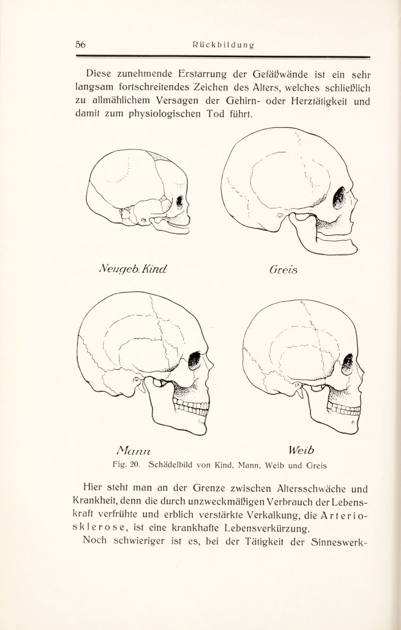 Diese zunehmende Erstarrung der Gefäßwände ist ein sehr langsam fortschreitendes Zeichen des Alters, welches schließlich zu allmählichem Versagen der Gehirn- oder Herztätigkeit und damit zum physiologischen Tod führt. Mann Weib Fig. 20. Schädelbild von Kind, Mann, Weib und Greis Hier steht man an der Grenze zwischen Altersschwäche und Krankheit, denn die durch unzweckmäßigen Verbrauch der Lebens¬ kraft verfrühte und erblich verstärkte Verkalkung, die Arterio¬ sklerose, ist eine krankhafte Lebensverkürzung. Noch schwieriger ist es, bei der Tätigkeit der Sinneswerk-