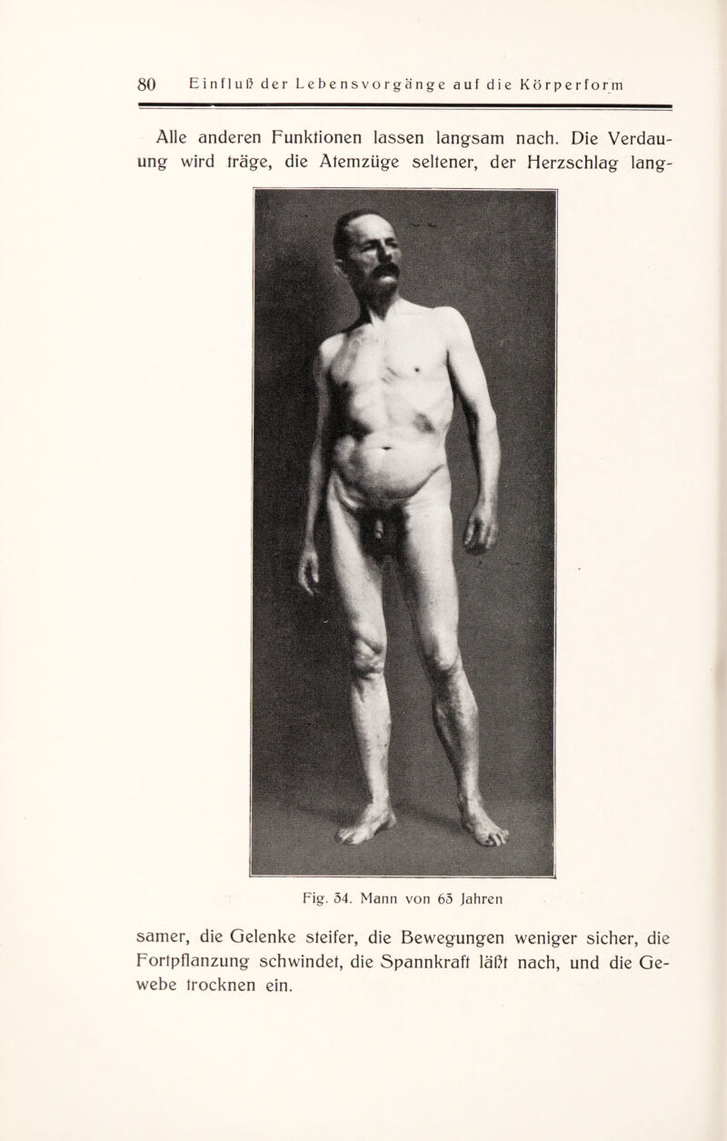 Alle anderen Funktionen lassen langsam nach. Die Verdau¬ ung wird träge, die Atemzüge seltener, der Herzschlag lang- Fig. 34. Mann von 65 Jahren samer, die Gelenke steifer, die Bewegungen weniger sicher, die Fortpflanzung schwindet, die Spannkraft läßt nach, und die Ge¬ webe trocknen ein.