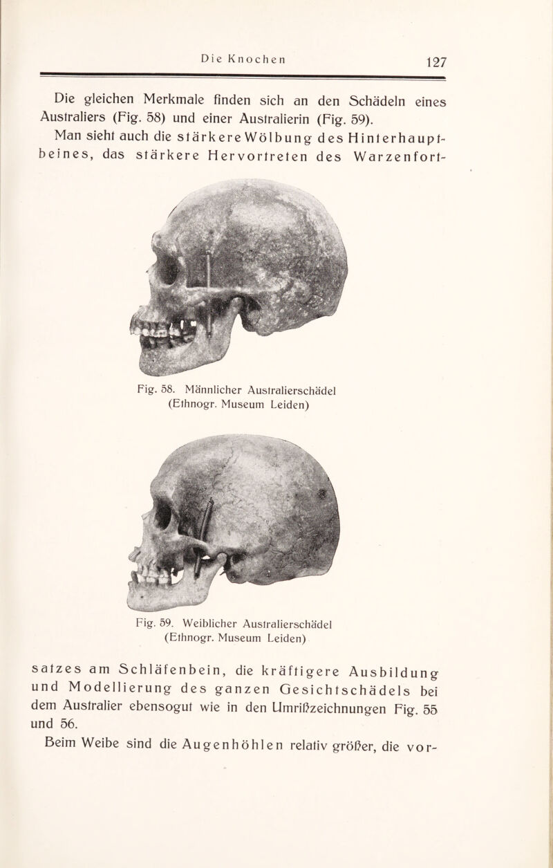 Die gleichen Merkmale finden sich an den Schädeln eines Australiers (Fig. 58) und einer Australierin (Fig. 59). Man sieht auch die stärkere Wölbung des Hinterhaupt¬ beines, das stärkere Hervortreten des Warzenfort- Fig. 58. Männlicher Australierschädel (Ethnogr. Museum Leiden) Fig. 59. Weiblicher Australierschädel (Ethnogr. Museum Leiden) satzes am Schläfenbein, die kräftigere Ausbildung und Modellierung des ganzen Gesichtschädels bei dem Australier ebensogut wie in den Umrißzeichnungen Fig. 55 und 56. Beim Weibe sind die Augenhöhlen relativ größer, die vor-