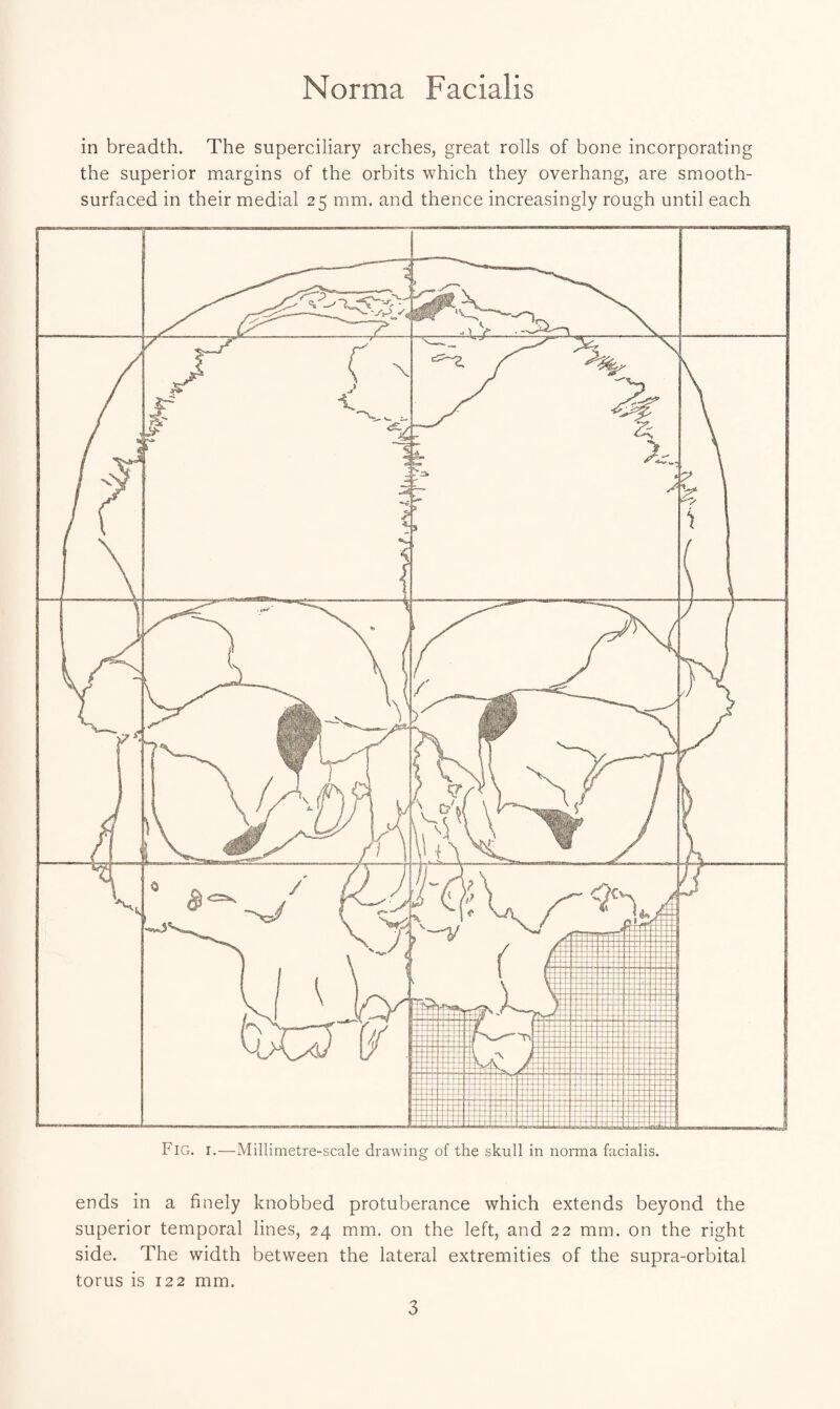 Norma Facialis in breadth. The superciliary arches, great rolls of bone incorporating the superior margins of the orbits which they overhang, are smooth¬ surfaced in their medial 25 mm. and thence increasingly rough until each Fig. I.—Millimetre-scale drawing of the skull in norma facialis. ends in a finely knobbed protuberance which extends beyond the superior temporal lines, 24 mm. on the left, and 22 mm. on the right side. The width between the lateral extremities of the supra-orbital torus is 122 mm.