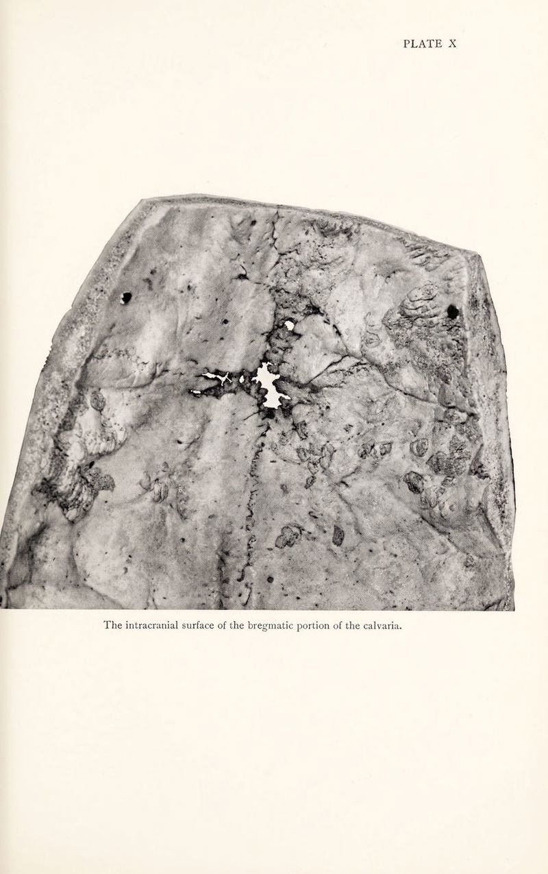 The intracranial surface of the bregmatic portion of the calvaria.