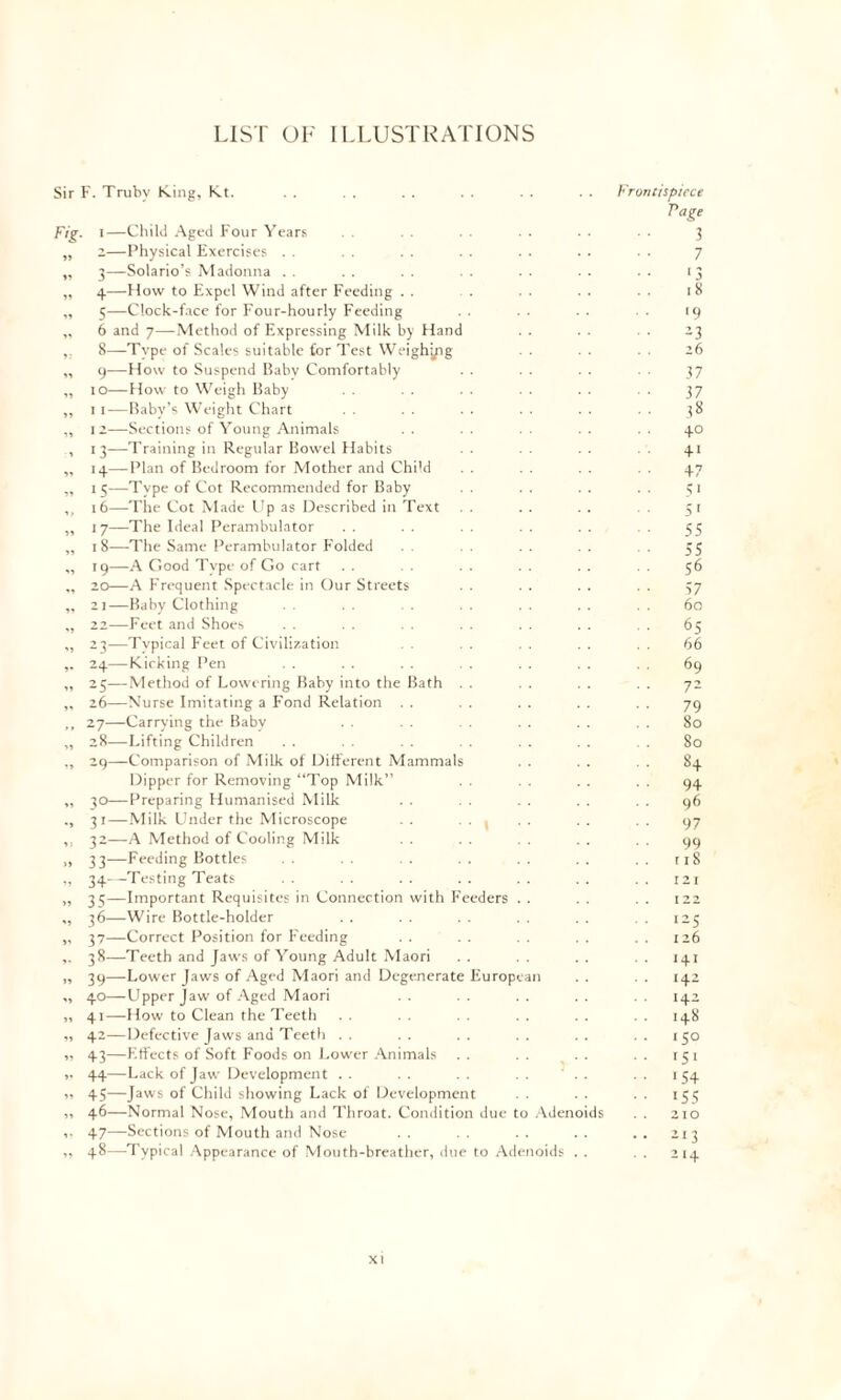 LIST OF L LUST RATIONS Sir F. Trubv King, Kt. Fig. i—Child Aged Four Years „ 2—Physical Exercises . . „ 3—Solario’s Madonna . . „ 4—How to Expel Wind after Feeding . . „ 5—Clock-face for Four-hourly Feeding ,, 6 and 7—Method of Expressing Milk by Hand ,. 8—Type of Scales suitable for Test Weighytg ,, 9—How to Suspend Babv Comfortably „ 10—How to Weigh Baby „ 11-—Baby’s Weight Chart ,, 12—Sections of Young Animals , 13—Training in Regular Bowel Habits „ 14—Plan of Bedroom for Mother and Child ,, 15—Type of Cot Recommended for Baby ,, 16—The Cot Made Up as Described in Text ,, 17—The Ideal Perambulator „ 18—The Same Perambulator F'olded „ 19—A Good Tvpe of Go cart ,, 20—A Frequent Spectacle in Our Streets „ 21—Baby Clothing „ 22—Feet and Shoes ,, 23—Typical Feet of Civilization ,. 24—Kicking Pen „ 25—Method of Lowering Baby into the Bath . . „ 26—Nurse Imitating a Fond Relation . . ,, 27—Carrying the Baby „ 28—Lifting Children „ 29—Comparison of Milk of Different Mammals Dipper for Removing “Top Milk” „ qo—Preparing Humanised Milk ., 31—Milk Under the Microscope ,. 32—A Method of Cooling Milk „ 33—Feeding Bottles „ 34—Testing Teats „ 35—Important Requisites in Connection with Feeders . . ,, 36—Wire Bottle-holder „ 37—Correct Position for Feeding 38—-Teeth and Jaws of Young Adult Maori „ 39—Lower Jaws of Aged Maori and Degenerate European ,, 40—Upper Jaw of Aged Maori „ 41—How to Clean the Teeth „ 42—Defective Jaws and Teeth . . „ 43—Effects of Soft Foods on Lower Animals i! 44—Lack of Jaw Development . . ,, 45—Jaws of Child showing Lack of Development 46— Normal Nose, Mouth and Throat. Condition due to Adenoids 47— Sections of Mouth and Nose „ 48—Typical Appearance of Mouth-breather, due to Adenoids . . Frontispiece Page 3 7 ‘3 18 19 23 26 37 37 •• 38 40 41 +7 51 5 [ 55 55 56 57 60 65 . . 66 69 72 79 80 80 .. 8+ 94 96 97 99 r 18 121 . . 122 125 . . 126 141 . . 142 142 . . 148 . . 150 . . 151 ■ ■ 154 • • 155 210 . . 213 . . 214