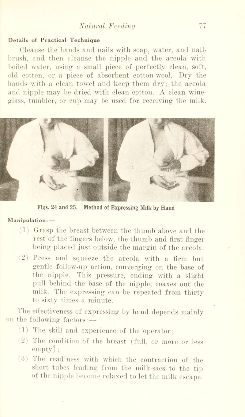 Details of Practical Technique l’lo;nise tlie luinds and nails with soap, water, and nail- hrnsh. ainl then cleanse the nip])le and the areola with boiled water, nsing' a small piece of perfectly clean, soft, old cotton, or a piece of absorbent cotton-wool. Dry the hands wilh a clean towel and keep them diw; the areola and nip])le may he dried with clean cotton. A clean wine- P'lass, tnmbler, or eu)) may be used for receiving: the milk. Figs. 24 and 25. Method of Expressing Milk by Hand Manipulation: — (1) Gras]) the breast between the thnmb above and the I'est of the fing’ers below, the thnmb and first finger being- ])laced just outside the margin of the areola. '2) I’ress and squeeze the areola with a firm but gentle follow-np action, converging on the base of the nipple. This pressure, ending with a slight j)ull behind the base of the nipple, coaxes out the milk. The expressing can be repeated from thirty to sixty times a minute. The etfectivene.ss of expressing by hand dei)ends maiidy on the following factors:— fl) The skill and experience of the operator; (2) The condition of the breast (full, or moi-e or less empty) ; fd) The i-eadiness with which the contraction of tin' .sliort tubes leading from the ndlk-sacs to the tij) of the nipple become relax(‘d to let the milk esca])(‘.