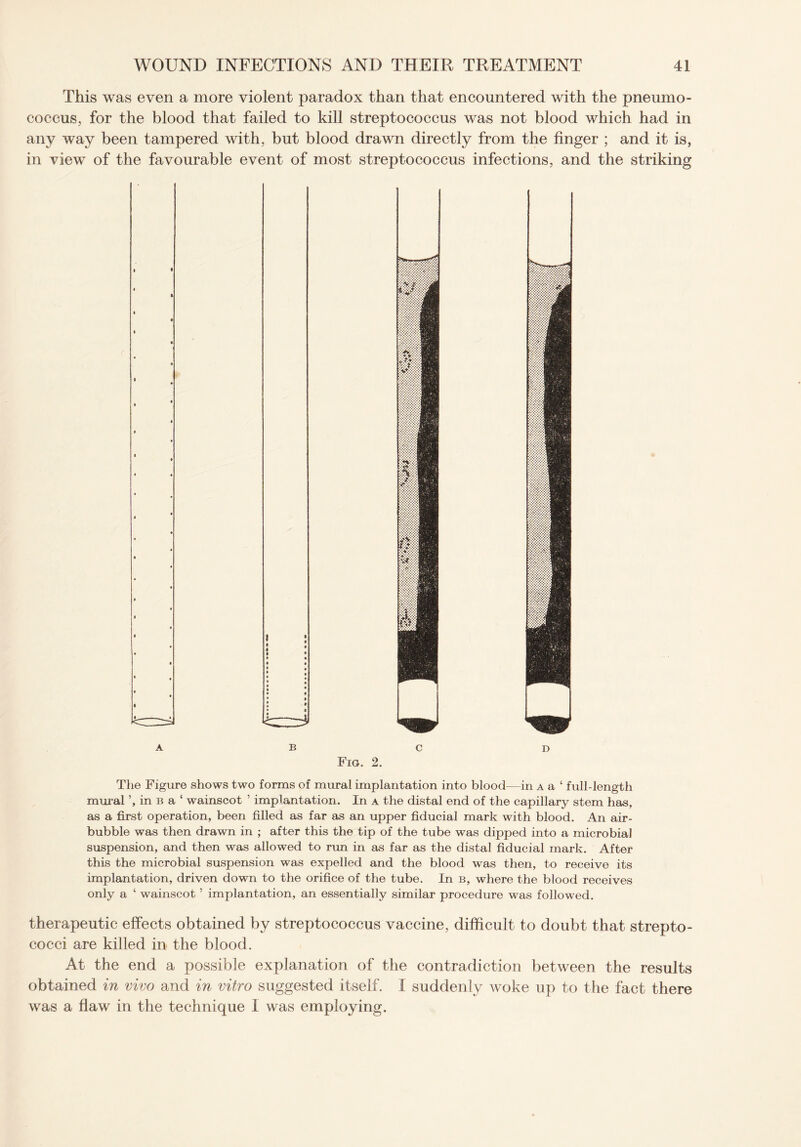 This was even a more violent paradox than that encountered with the pneumo¬ coccus, for the blood that failed to kill streptococcus was not blood which had in any way been tampered with, but blood drawn directly from the finger ; and it is, in view of the favourable event of most streptococcus infections, and the striking A BCD Fig. 2. The Figure shows two forms of mural implantation into blood—in a a ‘ full-length mural in b a ‘ wainscot ’ implantation. In a the distal end of the capillary stem has, as a first operation, been filled as far as an upper fiducial mark with blood. An air- bubble was then drawn in ; after this the tip of the tube was dipped into a microbial suspension, and then was allowed to run in as far as the distal fiducial mark. After this the microbial suspension was expelled and the blood was then, to receive its implantation, driven down to the orifice of the tube. In b, where the blood receives only a ‘ wainscot5 implantation, an essentially similar procedure was followed. therapeutic effects obtained by streptococcus vaccine, difficult to doubt that strepto¬ cocci are killed in the blood. At the end a possible explanation of the contradiction between the results obtained in vivo and in vitro suggested itself. I suddenly woke up to the fact there was a flaw in the technique I was employing.