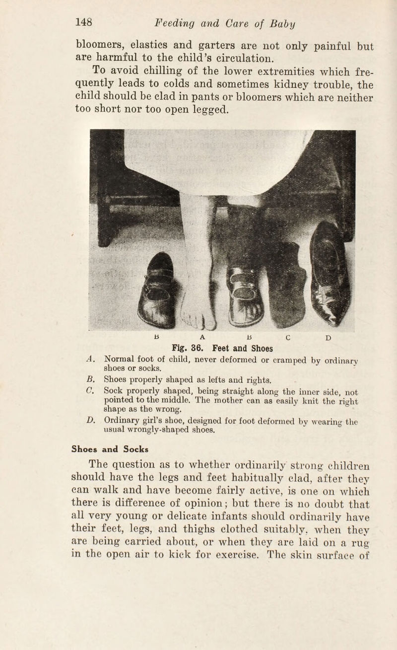 bloomers, elastics and garters are not only painful but are harmful to the child’s circulation. To avoid chilling of the lower extremities which fre¬ quently leads to colds and sometimes kidney trouble, the child should be clad in pants or bloomers which are neither too short nor too open legged. a A BCD Fig. 36. Feet and Shoes A. Normal foot of child, never deformed or cramped by ordinarv shoes or socks. B. Shoes properly shaped as lefts and rights. C. Sock properly shaped, being straight along the inner side, not pointed to the middle. The mother can as easily knit the right shape as the wrong. D. Ordinary girl’s shoe, designed for foot deformed by wearing the usual wrongly-shaped shoes. Shoes and Socks The question as to whether ordinarily strong children should have the legs and feet habitually clad, after they can walk and have become fairly active, is one on which there is difference of opinion; but there is no doubt that all very young or delicate infants should ordinarily have their feet, legs, and thighs clothed suitably, when they are being carried about, or when they are laid on a rug in the open air to kick for exercise. The skin surface of