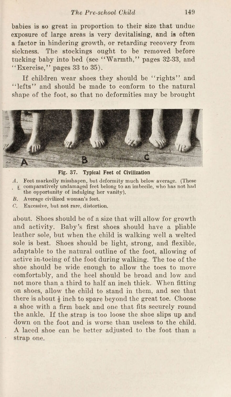 babies is so great iu proportion to their size that undue exposure of large areas is very devitalising, and is often a factor in hindering growth, or retarding recovery from sickness. The stockings ought to be removed before tucking baby into bed (see “Warmth,” pages 32-33, and “Exercise,” pages 33 to 35). If children wear shoes they should be “rights” and “lefts” and should be made to conform to the natural shape of the foot, so that no deformities may be brought Fig. 37. Typical Feet of Civilization .4. Feet markedly misshapen, but deformity much below average. (These ^ comparatively undamaged feet belong to an imbecile, who has not had the opportunity of indulging her vanity). B. Average civilized woman’s feet. C. Excessive, but not rare, distortion. about. Shoes should be of a size that will allow for growth and activity. Baby’s first shoes should have a pliable leather sole, but when the child is walking well a welted sole is best. Shoes should be light, strong, and flexible, adaptable to the natural outline of the foot, allowing of active in-toeing of the foot during walking. The toe of the shoe should be wide enough to allow the toes to move comfortably, and the heel should be broad and low and not more than a third to half an inch thick. When fitting on shoes, allow the child to stand in them, and see that there is about | inch to spare beyond the great toe. Choose a shoe with a firm back and one that fits securely round the ankle. If the strap is too loose the shoe slips up and down on the foot and is worse than useless to the child. A laced shoe can be better adjusted to the foot than a strap one.
