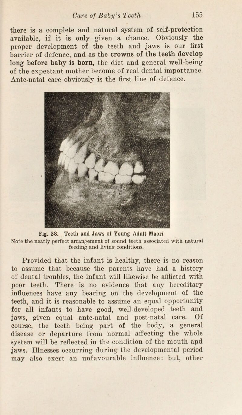 there is a complete and natural system of self-protection available, if it is only given a chance. Obviously the proper development of the teeth and jaws is our first barrier of defence, and as the crowns of the teeth develop long before baby is born, the diet and general well-being of the expectant mother become of real dental importance. Ante-natal care obviously is the first line of defence. Fig. 38. Teeth and Jaws of Young Adult Maori Note the nearly perfect arrangement of sound teeth associated with natural feeding and living conditions. Provided that the infant is healthy, there is no reason to assume that because the parents have had a history of dental troubles, the infant will likewise be afflicted with poor teeth. There is no evidence that any hereditary influences have any bearing on the development of the teeth, and it is reasonable to assume an equal opportunity for all infants to have good, well-developed teeth and jaws, given equal ante-natal and post-natal care. Of course, the teeth being part of the body, a general disease or departure from normal affecting the whole system will be reflected in the condition of the mouth apd jaws. Illnesses occurring during the developmental period may also exert an unfavourable influence: but, other