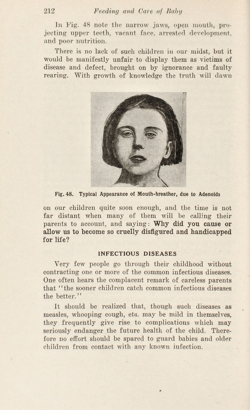 111 Fig. 48 note the narrow jaws, open mouth, pro¬ jecting upper teeth, vacant face, arrested development, and poor nutrition. There is no lack ol; such children in our midst, but it would be manifestly unfair to display them as victims of disease and defect, brought on by ignorance and faulty rearing. With growth of knowledge the truth will dawn Fig. 48. Typical Appearance of Mouth-breather, due to Adenoids on our children quite soon enough, and the time is not far distant when many of them will be calling their parents to account, and saying: Why did you cause or allow us to become so cruelly disfigured and handicapped for life? INFECTIOUS DISEASES Very few people go through their childhood without contracting one or more of the common infectious diseases. One often hears the complacent remark of careless parents that “the sooner children catch common infectious diseases the better.” It should be realized tliat, though such diseases as measles, whooping cough, etc. may be mild in themselves, they frequently give rise to complications which may seriously endanger the future health of the child. There¬ fore no effort should be spared to guard babies and older children from contact with any known infection.