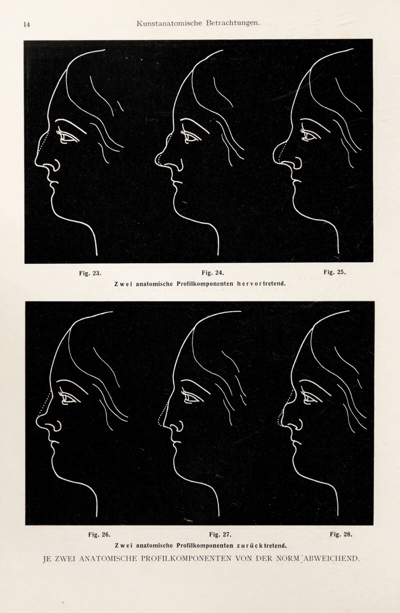 Fig. 23. Fig. 24. Fig. 25. Zwei anatomische Profilkomponenten h e r v o r tretend. Fig. 26. Fig. 27. Fig. 28. Zwei anatomische Profilkomponenten zurücktretend.