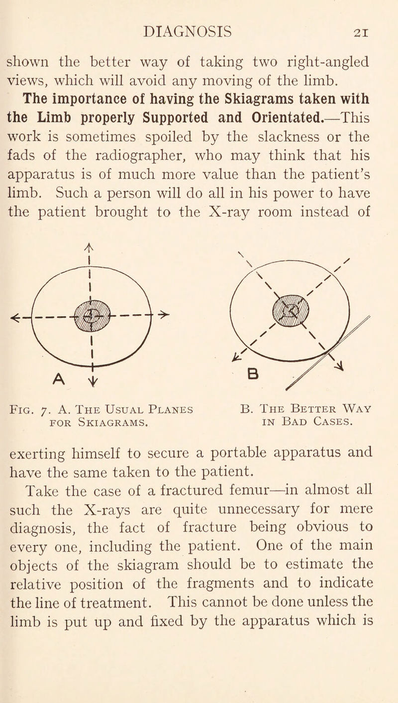 shown the better way of taking two right-angled views, which will avoid any moving of the limb. The importance of having the Skiagrams taken with the Limb properly Supported and Orientated.—This work is sometimes spoiled by the slackness or the fads of the radiographer, who may think that his apparatus is of much more value than the patient's limb. Such a person will do all in his power to have the patient brought to the X-ray room instead of Fig. 7. A. The Usual Planes for Skiagrams. B. The Better Way in Bad Cases. exerting himself to secure a portable apparatus and have the same taken to the patient. Take the case of a fractured femur—in almost all such the X-rays are quite unnecessary for mere diagnosis, the fact of fracture being obvious to every one, including the patient. One of the main objects of the skiagram should be to estimate the relative position of the fragments and to indicate the line of treatment. This cannot be done unless the limb is put up and fixed by the apparatus which is