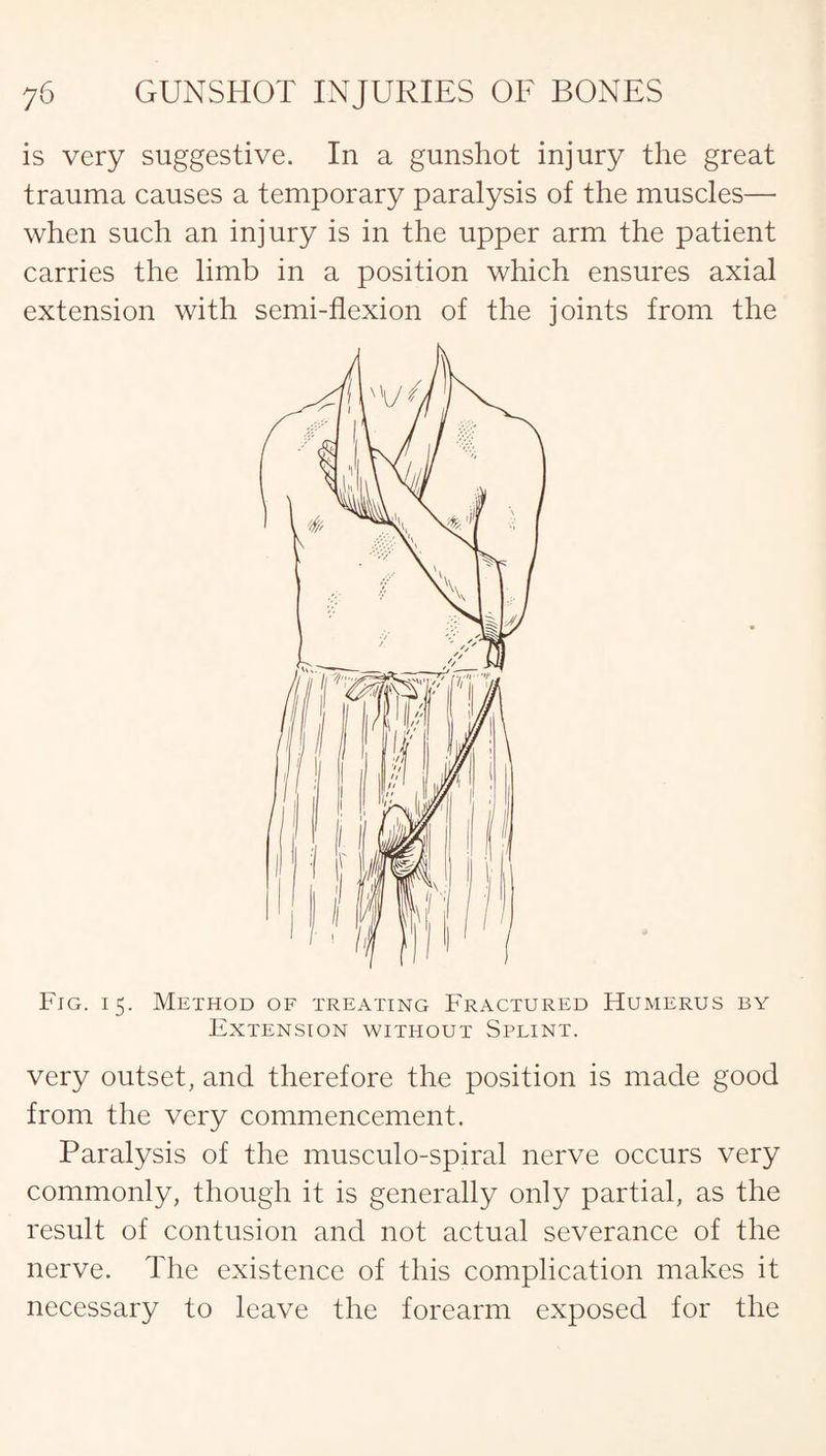 is very suggestive. In a gunshot injury the great trauma causes a temporary paralysis of the muscles— when such an injury is in the upper arm the patient carries the limb in a position which ensures axial extension with semi-flexion of the joints from the Fig. 15. Method of treating Fractured Humerus by Extension without Splint. very outset, and therefore the position is made good from the very commencement. Paralysis of the musculo-spiral nerve occurs very commonly, though it is generally only partial, as the result of contusion and not actual severance of the nerve. The existence of this complication makes it necessary to leave the forearm exposed for the