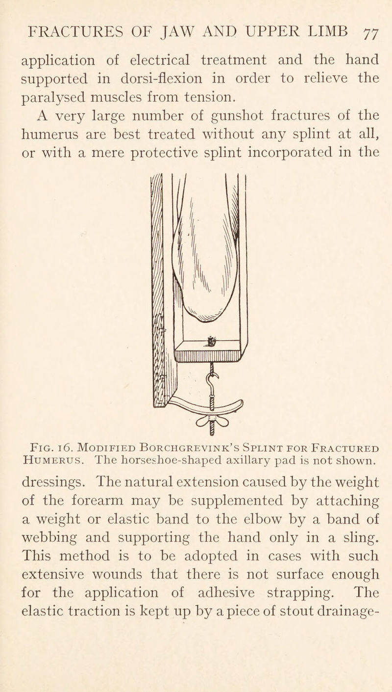application of electrical treatment and the hand supported in dorsi-flexion in order to relieve the paralysed muscles from tension. A very large number of gunshot fractures of the humerus are best treated without any splint at all, or with a mere protective splint incorporated in the Fig. 16. Modified Borchgrevink’s Splint for Fractured Humerus. The horseshoe-shaped axillary pad is not shown. dressings. The natural extension caused by the weight of the forearm may be supplemented by attaching a weight or elastic band to the elbow by a band of webbing and supporting the hand only in a sling. This method is to be adopted in cases with such extensive wounds that there is not surface enough for the application of adhesive strapping. The elastic traction is kept up by apiece of stout drainage-