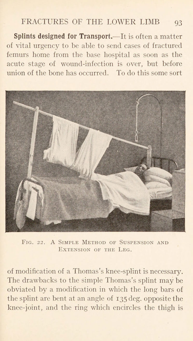 Splints designed for Transport.—It is often a matter of vital urgency to be able to send cases of fractured femurs home from the base hospital as soon as the acute stage of wound-infection is over, but before union of the bone has occurred. To do this some sort Fig. 22. A Simple Method of Suspension and Extension of the Leg. of modification of a Thomas’s knee-splint is necessary. The drawbacks to the simple Thomas’s splint may be obviated by a modification in which the long bars of the splint are bent at an angle of 135 deg. opposite the knee-joint, and the ring which encircles the thigh is