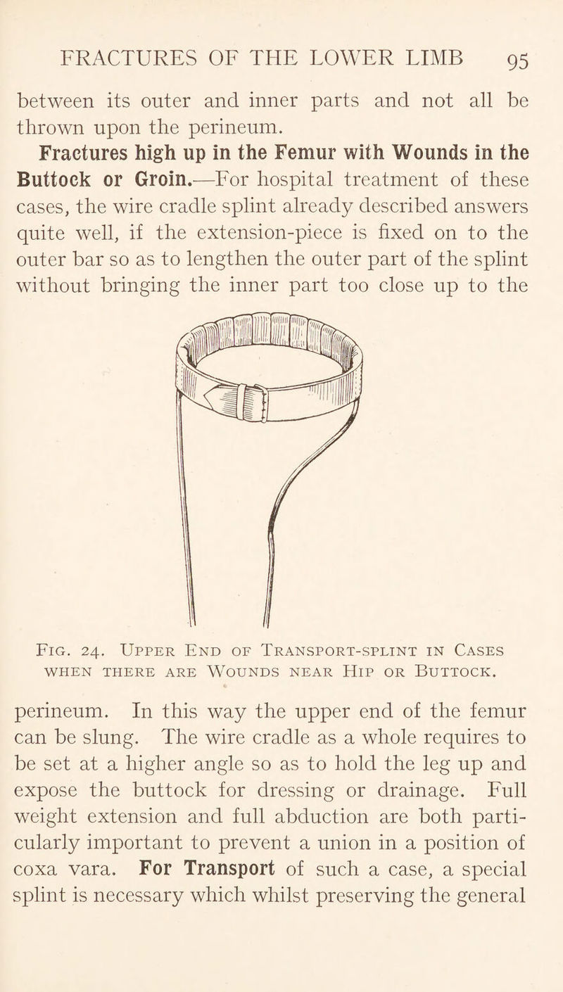between its outer and inner parts and not all be thrown upon the perineum. Fractures high up in the Femur with Wounds in the Buttock or Groin.—For hospital treatment of these cases, the wire cradle splint already described answers quite well, if the extension-piece is fixed on to the outer bar so as to lengthen the outer part of the splint without bringing the inner part too close up to the Fig. 24. Upper End of Transport-splint in Cases WHEN THERE ARE WOUNDS NEAR HlP OR BUTTOCK. perineum. In this way the upper end of the femur can be slung. The wire cradle as a whole requires to be set at a higher angle so as to hold the leg up and expose the buttock for dressing or drainage. Full weight extension and full abduction are both parti¬ cularly important to prevent a union in a position of coxa vara. For Transport of such a case, a special splint is necessary which whilst preserving the general
