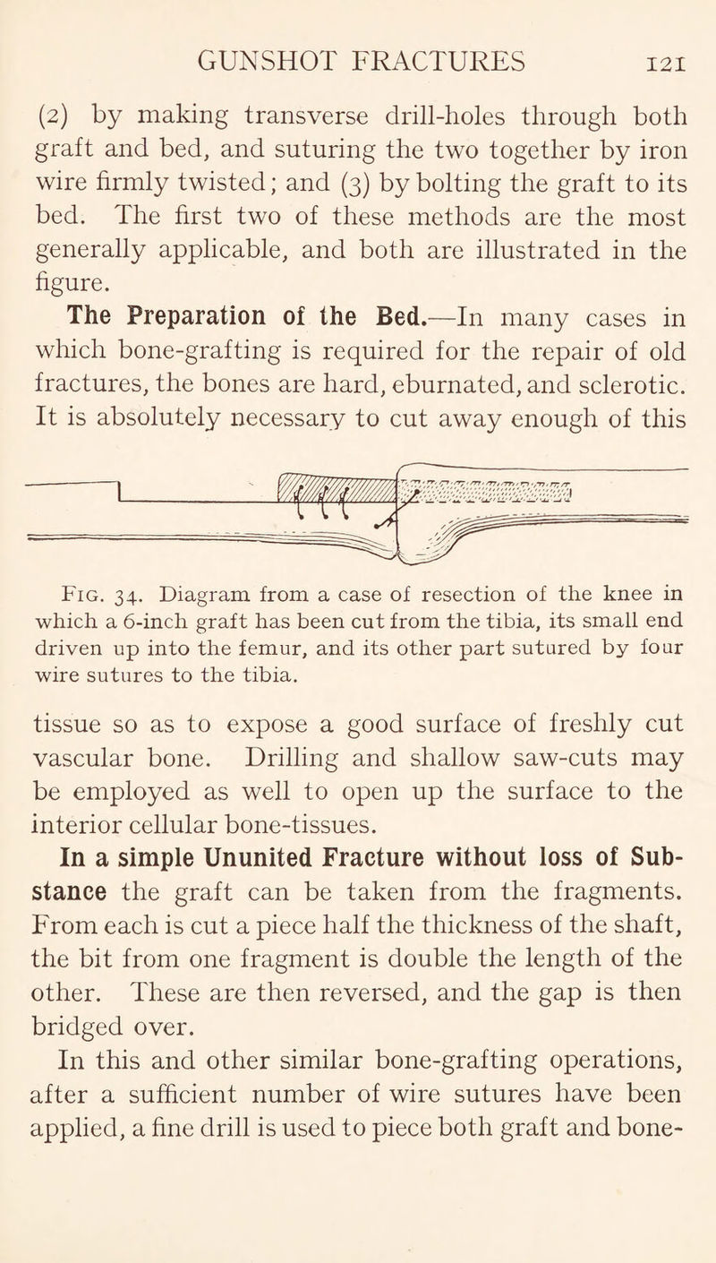 (2) by making transverse drill-holes through both graft and bed, and suturing the two together by iron wire firmly twisted; and (3) by bolting the graft to its bed. The first two of these methods are the most generally applicable, and both are illustrated in the figure. The Preparation of the Bed.—In many cases in which bone-grafting is required for the repair of old fractures, the bones are hard, eburnated, and sclerotic. It is absolutely necessary to cut away enough of this ~T Fig. 34. Diagram from a case of resection of the knee in which a 6-inch graft has been cut from the tibia, its small end driven up into the femur, and its other part sutured by four wire sutures to the tibia. tissue so as to expose a good surface of freshly cut vascular bone. Drilling and shallow saw-cuts may be employed as well to open up the surface to the interior cellular bone-tissues. In a simple Ununited Fracture without loss of Sub¬ stance the graft can be taken from the fragments. From each is cut a piece half the thickness of the shaft, the bit from one fragment is double the length of the other. These are then reversed, and the gap is then bridged over. In this and other similar bone-grafting operations, after a sufficient number of wire sutures have been applied, a fine drill is used to piece both graft and bone-