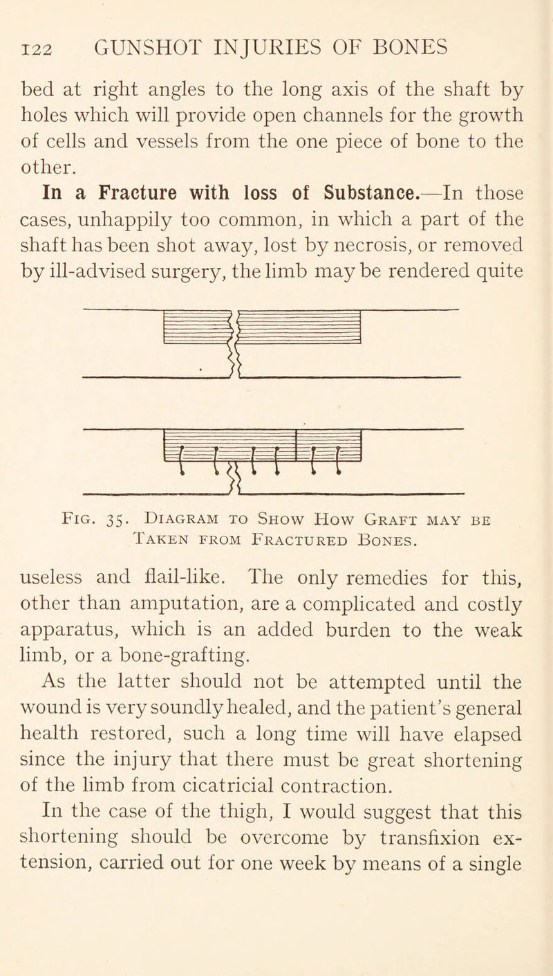 bed at right angles to the long axis of the shaft by holes which will provide open channels for the growth of cells and vessels from the one piece of bone to the other. In a Fracture with loss of Substance.—In those cases, unhappily too common, in which a part of the shaft has been shot away, lost by necrosis, or removed by ill-advised surgery, the limb may be rendered quite Fig. 35. Diagram to Show How Graft may be Taken from Fractured Bones. useless and flail-like. The only remedies for this, other than amputation, are a complicated and costly apparatus, which is an added burden to the weak limb, or a bone-grafting. As the latter should not be attempted until the wound is very soundly healed, and the patient’s general health restored, such a long time will have elapsed since the injury that there must be great shortening of the limb from cicatricial contraction. In the case of the thigh, I would suggest that this shortening should be overcome by transfixion ex¬ tension, carried out for one week by means of a single
