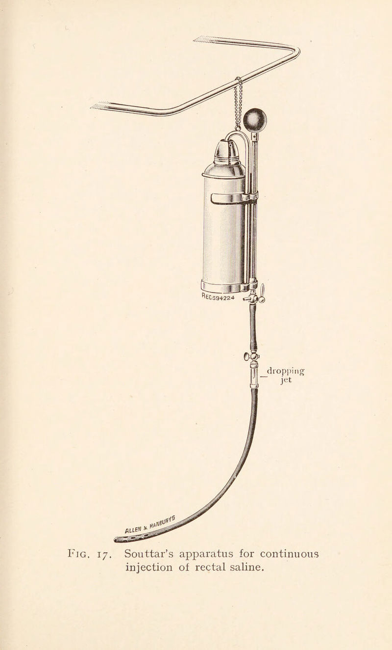 injection of rectal saline.