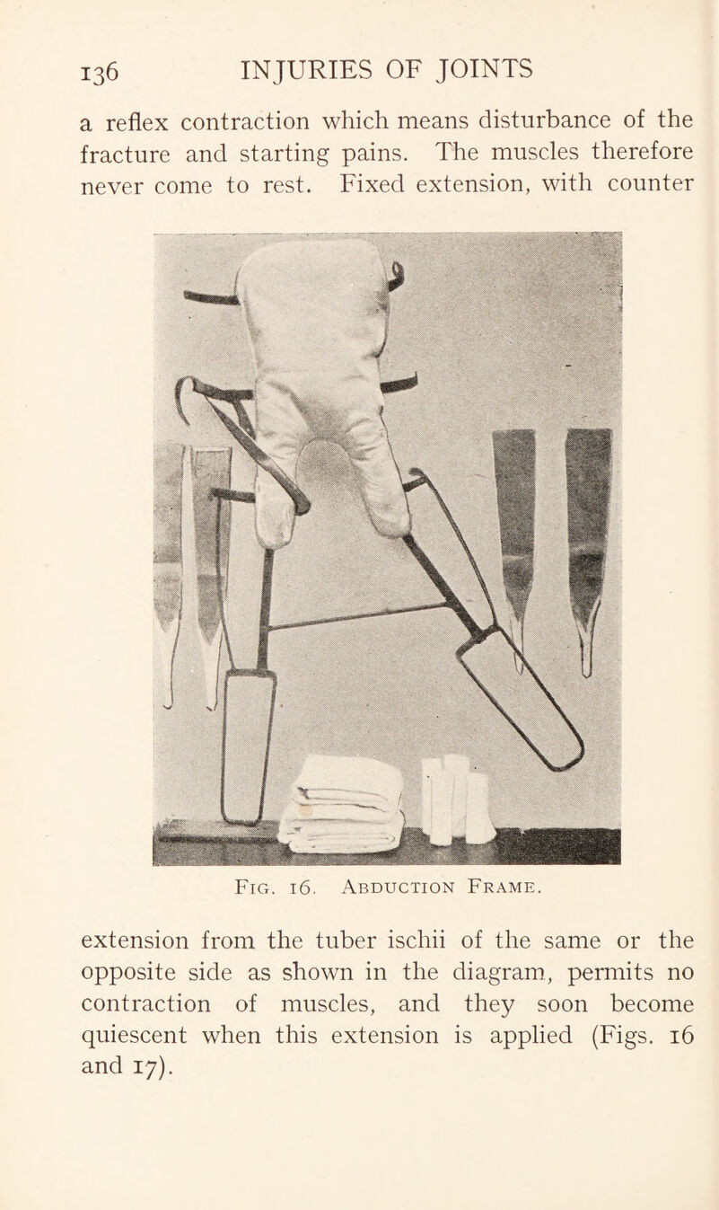 a reflex contraction which means disturbance of the fracture and starting pains. The muscles therefore never come to rest. Fixed extension, with counter Fig. 16. Abduction Frame. extension from the tuber ischii of the same or the opposite side as shown in the diagram, permits no contraction of muscles, and they soon become quiescent when this extension is applied (Figs. 16 and 17).