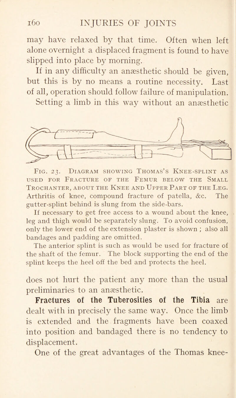 may have relaxed by that time. Often when left alone overnight a displaced fragment is found to have slipped into place by morning. If in any difficulty an anaesthetic should be given, but this is by no means a routine necessity. Last of all, operation should follow failure of manipulation. Setting a limb in this way without an anaesthetic used for Fracture of the Femur below the Small Trochanter, about the Knee and Upper Part of the Leg. Arthritis of knee, compound fracture of patella, &c. The gutter-splint behind is slung from the side-bars. If necessary to get free access to a -wound about the knee, leg and thigh would be separately slung. To avoid confusion, only the lower end of the extension plaster is shown ; also all bandages and padding are omitted. The anterior splint is such as would be used for fracture of the shaft of the femur. The block supporting the end of the splint keeps the heel off the bed and protects the heel. does not hurt the patient any more than the usual preliminaries to an anaesthetic. Fractures of the Tuberosities of the Tibia are dealt with in precisely the same way. Once the limb is extended and the fragments have been coaxed into position and bandaged there is no tendency to displacement. One of the great advantages of the Thomas knee-