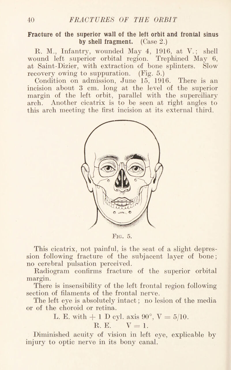 Fracture of the superior wall of the left orbit and frontal sinus by shell fragment. (Case 2.) R. M., Infantry, wounded May 4, 1916, at V.; shell wound left superior orbital region. Trephined May 6, at Saint-Dizier, with extraction of bone splinters. Slow recovery owing to suppuration. (Fig. 5.) Condition on admission, June 15, 1916. There is an incision about 3 cm. long at the level of the sujoerior margin of the left orbit, parallel with the superciliary arch. Another cicatrix is to be seen at right angles to this arch meeting the first incision at its external third. This cicatrix, not painful, is the seat of a slight depres¬ sion following fracture of the subjacent layer of bone; no cerebral pulsation perceived. Radiogram confirms fracture of the superior orbital margin. There is insensibility of the left frontal region following section of filaments of the frontal nerve. The left eye is absolutely intact; no lesion of the media or of the choroid or retina. L. E. with -f 1 D cyl. axis 90°, V = 5/10. R. E. V=l. Diminished acuity of vision in left eye, explicable by injury to optic nerve in its bony canal.