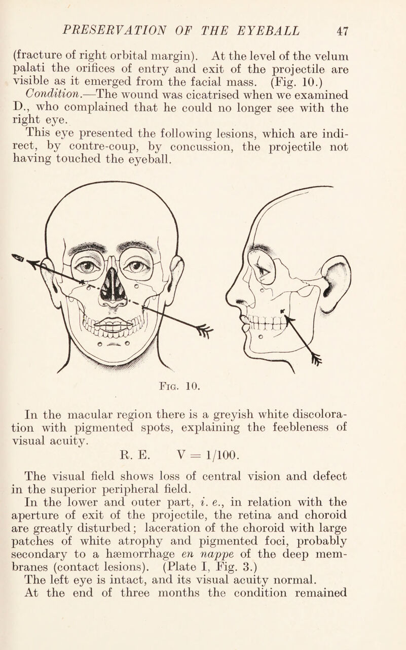 (fracture of right orbital margin). At the level of the velum palati the orifices of entry and exit of the projectile are visible as it emerged from the facial mass. (Fig. 10.) Condition.—The wound was cicatrised when we examined D., who complained that he could no longer see with the right eye. This eye presented the following lesions, which are indi¬ rect, by contre-coup, by concussion, the projectile not having touched the eyeball. In the macular region there is a greyish white discolora¬ tion with pigmented spots, explaining the feebleness of visual acuity. R. E. V= 1/100. The visual field shows loss of central vision and defect in the superior peripheral field. In the lower and outer part, i. e., in relation with the aperture of exit of the projectile, the retina and choroid are greatly disturbed; laceration of the choroid with large patches of white atrophy and pigmented foci, probably secondary to a haemorrhage en nappe of the deep mem¬ branes (contact lesions). (Plate I, Fig. 3.) The left eye is intact, and its visual acuity normal. At the end of three months the condition remained