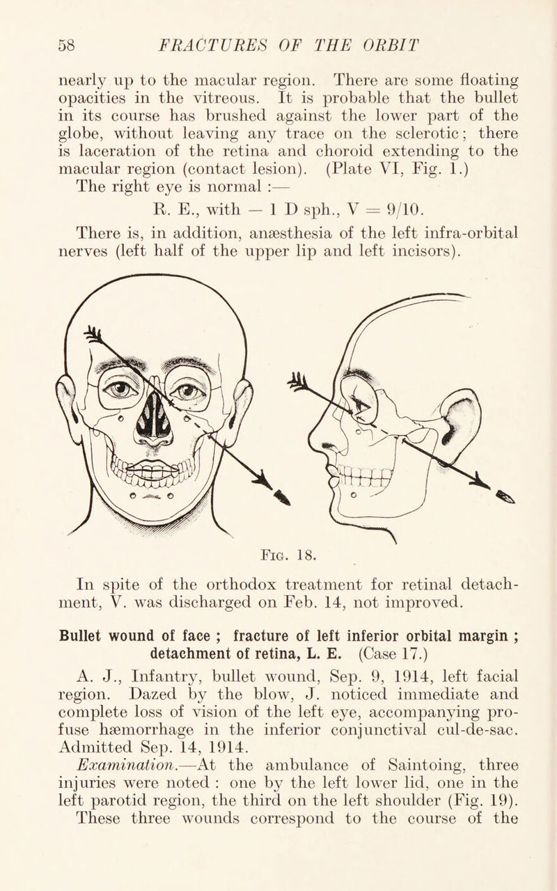 nearly up to the macular region. There are some floating opacities in the vitreous. It is probable that the bullet in its course has brushed against the lower part of the globe, without leaving any trace on the sclerotic; there is laceration of the retina and choroid extending to the macular region (contact lesion). (Plate VI, Fig. 1.) The right eye is normal :— R. E., with — ID sph., V — 9/10. There is, in addition, anaesthesia of the left infra-orbital nerves (left half of the upper lip and left incisors). In spite of the orthodox treatment for retinal detach¬ ment, V. was discharged on Feb. 14, not improved. Bullet wound of face ; fracture of left inferior orbital margin ; detachment of retina, L. E. (Case 17.) A. J., Infantry, bullet wound, Sep. 9, 1914, left facial region. Dazed by the blow, J. noticed immediate and complete loss of vision of the left eye, accompanying pro¬ fuse haemorrhage in the inferior conjunctival cul-de-sac. Admitted Sep. 14, 1914. Examination.—At the ambulance of Saintoing, three injuries were noted : one by the left lower lid, one in the left parotid region, the third on the left shoulder (Fig. 19). These three wounds correspond to the course of the