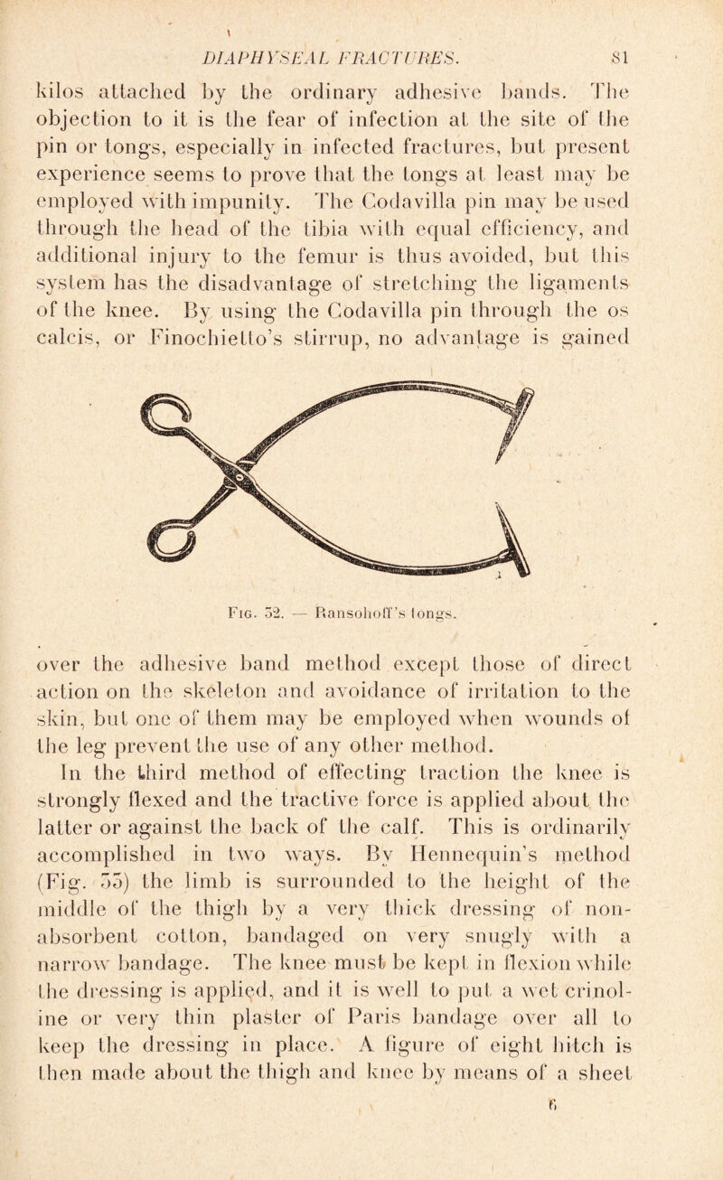 SI DIAPHYSEAL FRACTURES. kilos attached by the ordinary adhesive bands. The objection to it is the fear of infection at the site of the pin or tongs, especially in infected fractures, but present experience seems to prove that the longs at least may be employed with impunity. The Codavilla pin may be used through the head of the tibia with equal efficiency, and additional injury to the femur is thus avoided, but this system has the disadvantage of stretching the ligaments of the knee. By using the Codavilla pin through the os calcis, or Finochietto’s stirrup, no advantage is gained over the adhesive band method except those of direct action on the skeleton and avoidance of irritation to the skin, but one of them may be employed when wounds ol the leg prevent the use of any other method. In the third method of effecting traction the knee is strongly flexed and the tractive force is applied about the latter or against the back of the calf. This is ordinarily accomplished in two ways. By Hennequin’s method (Fig. bo) the limb is surrounded to the height of the middle of the thigh by a very thick dressing of non- absorbent cotton, bandaged on very snugly with a narrow bandage. The knee must be kept in flexion while the dressing is applied, and it is well to put a wet crinol¬ ine or very thin plaster of Paris bandage over all to keep the dressing in place. A figure of eight hitch is then made about the thigh and knee by means of a sheet r