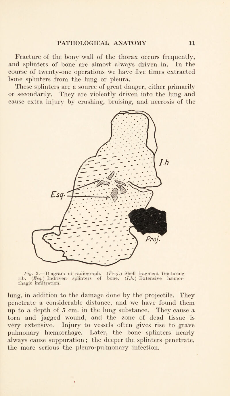 Fracture of the bony wall of the thorax occurs frequently, and splinters of bone are almost always driven in. In the course of twenty-one operations we have five times extracted bone splinters from the lung or pleura. These splinters are a source of great danger, either primarily or secondarily. They are violently driven into the lung and cause extra injury by crushing, bruising, and necrosis of the Fig. 3.—Diagram of radiograph. (Pro].) Shell fragment fracturing rib. (Esq. ) Indriven splinters of bone. (I.h.) Extensive haemor¬ rhagic infiltration. lung, in addition to the damage done by the projectile. They penetrate a considerable distance, and we have found them up to a depth of 5 cm. in the lung substance. They cause a torn and jagged wound, and the zone of dead tissue is very extensive. Injury to vessels often gives rise to grave pulmonary haemorrhage. Later, the bone splinters nearly always cause suppuration ; the deeper the splinters penetrate, the more serious the pleuro-pulmonary infection.