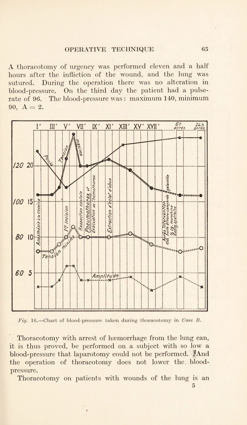 A thoracotomy of urgency was performed eleven and a half hours after the infliction of the wound, and the lung was sutured. During the operation there was no alteration in blood-pressure. On the third day the patient had a pulse- rate of 96. The blood-pressure was : maximum 140, minimum 90, A = 2. Fig. 16.—Chart of blood-pressure taken during thoracotomy in Case B. Thoracotomy with arrest of hæmorrhage from the lung can, it is thus proved, be performed on a subject with so low a blood-pressure that laparotomy could not be performed. And the operation of thoracotomy does not lower the, blood- pressure. Thoracotomy on patients with wounds of the lung is an 5