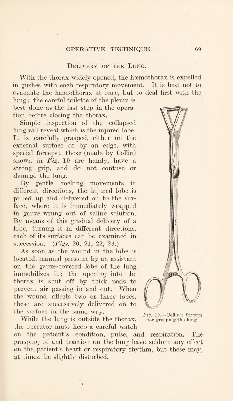 Delivery of the Lung. With the thorax widely opened, the hæmothorax is expelled in gushes with each respiratory movement. It is best not to evacuate the hæmothorax at once, but to deal first with the lung ; the careful toilette of the pleura is best done as the last step in the opera¬ tion before closing the thorax. Simple inspection of the collapsed lung will reveal which is the injured lobe. It is carefully grasped, either on the external surface or by an edge, with special forceps ; those (made by Collin) shown in Fig. 19 are handy, have a strong grip, and do not contuse or damage the lung. By gentle rocking movements in different directions, the injured lobe is pulled up and delivered on to the sur¬ face, where it is immediately wrapped in gauze wrung out of saline solution. By means of this gradual delivery of a lobe, turning it in different directions, each of its surfaces can be examined in succession. (Figs. 20, 21, 22, 23.) As soon as the wound in the lobe is located, manual pressure by an assistant on the gauze-covered lobe of the lung immobilizes it ; the opening into the thorax is shut off by thick pads to prevent air passing in and out. When the wound affects two or three lobes, these are successively delivered on to the surface in the same way. While the lung is outside the thorax, the operator must keep a careful watch on the patient’s condition, pulse, and respiration. The grasping of and traction on the lung have seldom any effect on the patient’s heart or respiratory rhythm, but these may, at times, be slightly disturbed. Fig. 19.—Collin’s forceps for grasping the lung.